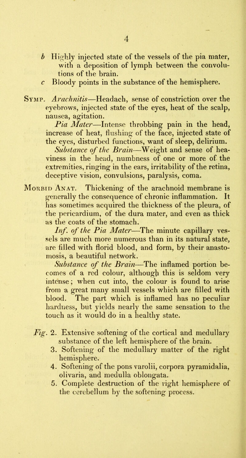 b Highly injected state of the vessels of the pia mater, with a deposition of lymph between the convolu- tions of the brain. c Bloody points in the substance of the hemisphere. Symp. Arachnitis—Headach, sense of constriction over the eyebrows, injected state of the eyes, heat of the scalp, nausea, agitation. Pia Mater—Intense throbbing pain in the head, increase of heat, flushing of the face, injected state of the eyes, disturbed functions, want of sleep, delirium. Substance of the Brain—Weight and sense of hea- viness in the head, numbness of one or more of the extremities, ringing in the ears, irritability of the retina, deceptive vision, convulsions, paralysis, coma. Morbid Anat. Thickening of the arachnoid membrane is generally the consequence of chronic inflammation. It has sometimes acquired the thickness of the pleura, of the pericardium, of the dura mater, and even as thick as the coats of the stomach. Inf. of the Pia Mater—The minute capillary ves- sels are much more numerous than in its natural state, are filled with florid blood, and form, by their anasto- mosis, a beautiful network. Substance of the Brain—The inflamed portion be- comes of a red colour, although this is seldom very intense; when cut into, the colour is found to arise from a great many small vessels which are filled with blood. The part which is inflamed has no peculiar hardness, but yields nearly the same sensation to the touch as it would do in a healthy state. Fig. 2. Extensive softening of the cortical and medullary substance of the left hemisphere of the brain. 3. Softening of the medullary matter of the right hemisphere. 4. Softening of the pons varolii, corpora pyramidalia, olivaria, and medulla oblongata. 5. Complete destruction of the right hemisphere of the cerebellum by the softening process.