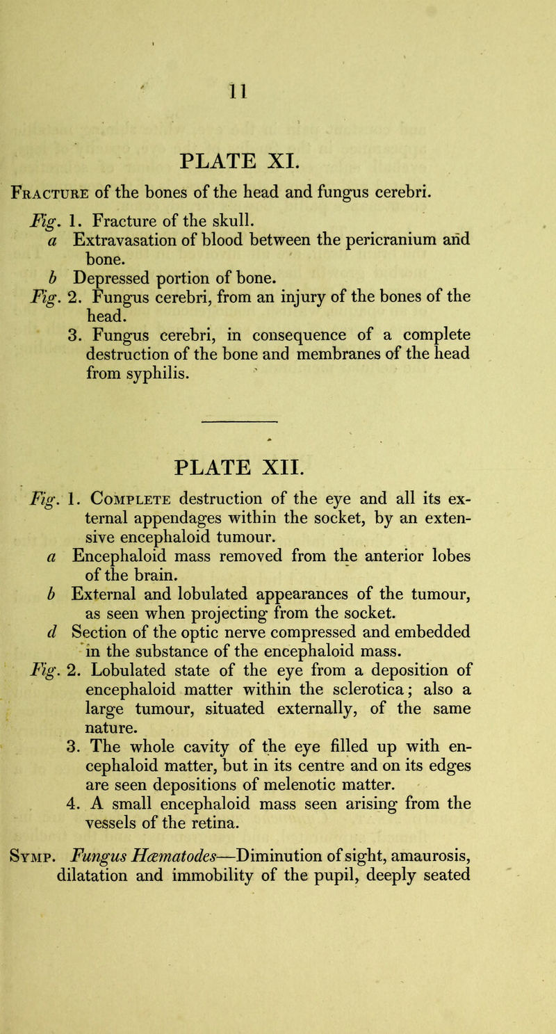 PLATE XI. Fracture of the bones of the head and fungus cerebri. Fig. 1. Fracture of the skull. a Extravasation of blood between the pericranium arid bone. b Depressed portion of bone. Fig. 2. Fungus cerebri, from an injury of the bones of the head. 3. Fungus cerebri, in consequence of a complete destruction of the bone and membranes of the head from syphilis. PLATE XII. Fig. 1. Complete destruction of the eye and all its ex- ternal appendages within the socket, by an exten- sive encephaloid tumour. a Encephaloid mass removed from the anterior lobes of the brain. b External and lobulated appearances of the tumour, as seen when projecting from the socket. d Section of the optic nerve compressed and embedded in the substance of the encephaloid mass. Fig. 2. Lobulated state of the eye from a deposition of encephaloid matter within the sclerotica; also a large tumour, situated externally, of the same nature. 3. The whole cavity of the eye filled up with en- cephaloid matter, but in its centre and on its edges are seen depositions of melenotic matter. 4. A small encephaloid mass seen arising from the vessels of the retina. Symp. Fungus Fl&matodes—Diminution of sight, amaurosis, dilatation and immobility of the pupil, deeply seated