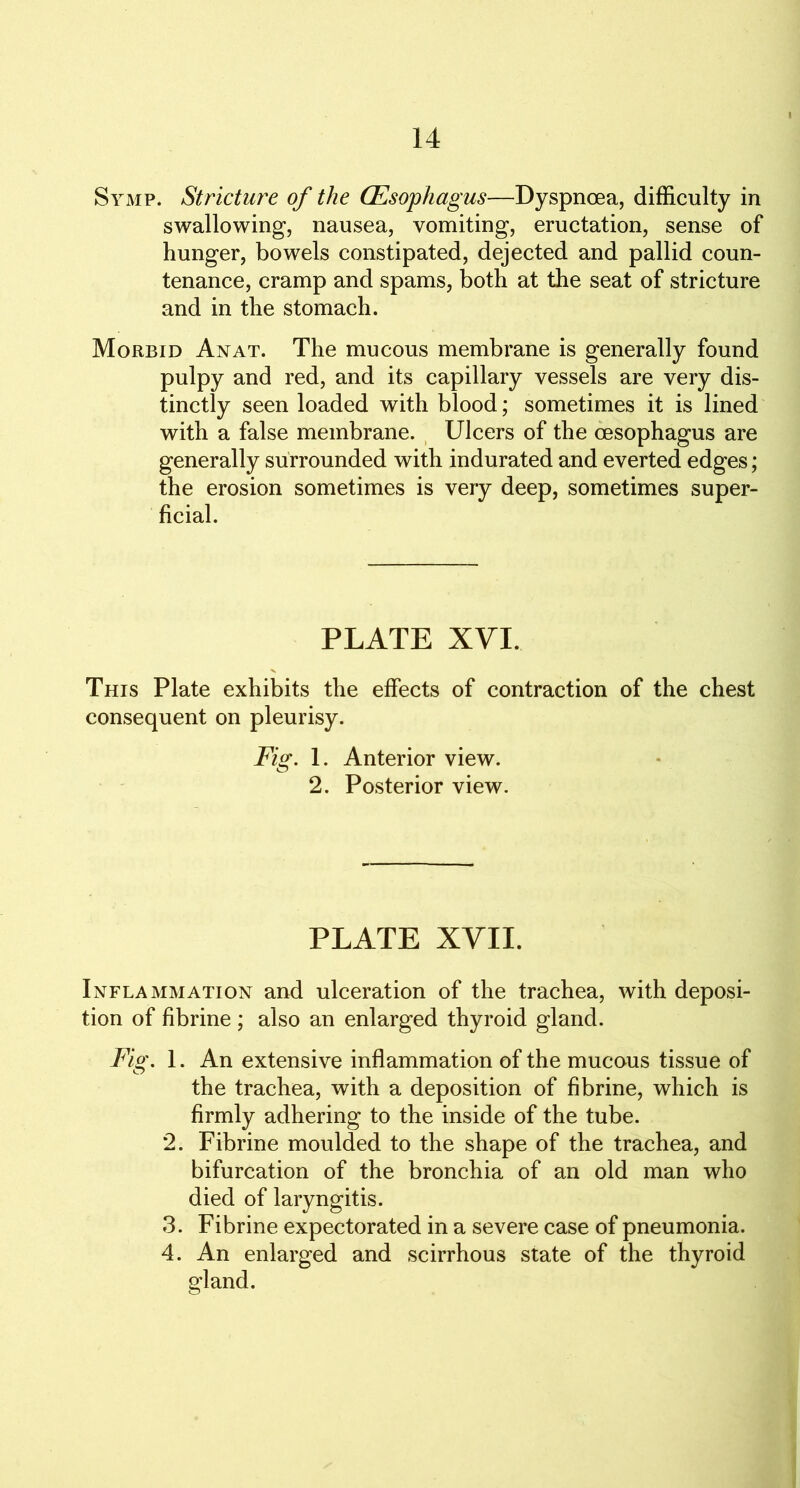 Symp. Stricture of the (Esophagus—Dyspnoea, difficulty in swallowing, nausea, vomiting, eructation, sense of hunger, bowels constipated, dejected and pallid coun- tenance, cramp and spams, both at the seat of stricture and in the stomach. Morbid An at. The mucous membrane is generally found pulpy and red, and its capillary vessels are very dis- tinctly seen loaded with blood; sometimes it is lined with a false membrane. Ulcers of the oesophagus are generally surrounded with indurated and everted edges; the erosion sometimes is very deep, sometimes super- ficial. PLATE XVI. This Plate exhibits the effects of contraction of the chest consequent on pleurisy. Fig. 1. Anterior view. 2. Posterior view. PLATE XVII. Inflammation and ulceration of the trachea, with deposi- tion of fibrine ; also an enlarged thyroid gland. Fig. 1. An extensive inflammation of the mucous tissue of the trachea, with a deposition of fibrine, which is firmly adhering to the inside of the tube. 2. Fibrine moulded to the shape of the trachea, and bifurcation of the bronchia of an old man who died of laryngitis. 3. Fibrine expectorated in a severe case of pneumonia. 4. An enlarged and scirrhous state of the thyroid gland.