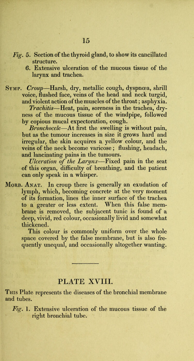 Fig. 5. Section of the thyroid gland, to show its cancillated structure. 6. Extensive ulceration of the mucous tissue of the larynx and trachea. Symp. Croup—Harsh, dry, metallic cough, dyspnoea, shrill voice, flushed face, veins of the head and neck turgid, and violent action of the muscles of the throat; asphyxia. Trachitis—Heat, pain, soreness in the trachea, dry- ness of the mucous tissue of the windpipe, followed by copious mucal expectoration, cough. Bronchocele—At first the swelling is without pain, but as the tumour increases in size it grows hard and irregular, the skin acquires a yellow colour, and the veins of the neck become varicose; flushing, headach, and lancinating pains in the tumours. Ulceration of the Larynx—Fixed pain in the seat of this organ, difficulty of breathing, and the patient can only speak in a whisper. Morb. Anat. In croup there is generally an exudation of lymph, which, becoming concrete at the very moment of its formation, lines the inner surface of the trachea to a greater or less extent. When this false mem- brane is removed, the subjacent tunic is found of a deep, vivid, red colour, occasionally livid and somewhat thickened. This colour is commonly uniform over the whole space covered by the false membrane, but is also fre- quently unequal, and occasionally altogether wanting. PLATE XVIII. This Plate represents the diseases of the bronchial membrane and tubes. Fig. 1. Extensive ulceration of the mucous tissue of the right bronchial tube.
