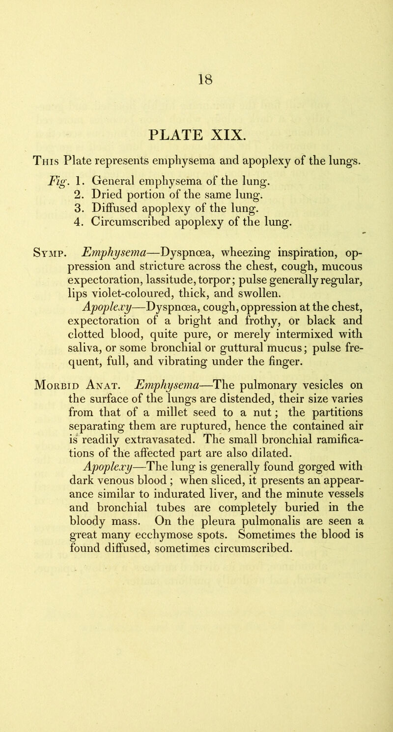 PLATE XIX. This Plate represents emphysema and apoplexy of the lungs. Fig. 1. General emphysema of the lung. 2. Dried portion of the same lung. 3. Diffused apoplexy of the lung. 4. Circumscribed apoplexy of the lung. Symp. Emphysejna—Dyspnoea, wheezing inspiration, op- pression and stricture across the chest, cough, mucous expectoration, lassitude, torpor; pulse generally regular, lips violet-coloured, thick, and swollen. Apoplexy—Dyspnoea, cough, oppression at the chest, expectoration of a bright and frothy, or black and clotted blood, quite pure, or merely intermixed with saliva, or some bronchial or guttural mucus; pulse fre- quent, full, and vibrating under the finger. Morbid Anat. Emphysema—The pulmonary vesicles on the surface of the lungs are distended, their size varies from that of a millet seed to a nut; the partitions separating them are ruptured, hence the contained air is readily extravasated. The small bronchial ramifica- tions of the affected part are also dilated. Apoplexy—The lung is generally found gorged with dark venous blood ; when sliced, it presents an appear- ance similar to indurated liver, and the minute vessels and bronchial tubes are completely buried in the bloody mass. On the pleura pulmonalis are seen a great many ecchymose spots. Sometimes the blood is found diffused, sometimes circumscribed.
