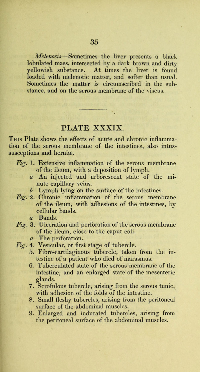 Melenosis—Sometimes the liver presents a black lobulated mass, intersected by a dark brown and dirty yellowish substance. At times the liver is found loaded with melenotic matter, and softer than usual. Sometimes the matter is circumscribed in the sub- stance, and on the serous membrane of the viscus. PLATE XXXIX. This Plate shows the effects of acute and chronic inflamma- tion of the serous membrane of the intestines, also intus- susceptions and hernise. Fig. 1. Extensive inflammation of the serous membrane of the ileum, with a deposition of lymph. a An injected and arborescent state of the mi- nute capillary veins. b Lymph lying on the surface of the intestines. Fig. 2. Chronic inflammation of the serous membrane of the ileum, with adhesions of the intestines, by cellular bands. a Bands. Fig. 3. Ulceration and perforation of the serous membrane of the ileum, close to the caput coli. a The perforation. Fig. 4. Vesicular, or first stage of tubercle. 5. Fibro-cartilaginous tubercle, taken from the in- testine of a patient who died of marasmus. 6. Tuberculated state of the serous membrane of the intestine, and an enlarged state of the mesenteric glands. 7. Scrofulous tubercle, arising from the serous tunic, with adhesion of the folds of the intestine. 8. Small fleshy tubercles, arising from the peritoneal surface of the abdominal muscles. 9. Enlarged and indurated tubercles, arising from the peritoneal surface of the abdominal muscles.