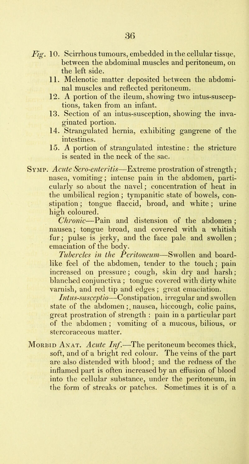 Fig. 10. Scirrhous tumours, embedded in the cellular tissue, between the abdominal muscles and peritoneum, on the left side. 11. Melenotic matter deposited between the abdomi- nal muscles and reflected peritoneum. 12. A portion of the ileum, showing two intussuscep- tions, taken from an infant. 13. Section of an intussusception, showing the inva- ginated portion. 14. Strangulated hernia, exhibiting gangrene of the intestines. 15. A portion of strangulated intestine: the stricture is seated in the neck of the sac. Symp. Acute Sero-enteritis—Extreme prostration of strength; nasea, vomiting; intense pain in the abdomen, parti- cularly so about the navel; concentration of heat in the umbilical region; tympanitic state of bowels, con- stipation ; tongue flaccid, broad, and white; urine high coloured. Chronic—Pain and distension of the abdomen ; nausea; tongue broad, and covered with a whitish fur; pulse is jerky, and the face pale and swollen; emaciation of the body. Tubercles in the Peritoneum—Swollen and board- like feel of the abdomen, tender to the touch; pain increased on pressure; cough, skin dry and harsh; blanched conjunctiva; tongue covered with dirty white varnish, and red tip and edges; great emaciation. Intus-susceptio—Constipation, irregular and swollen state of the abdomennausea, hiccough, colic pains, great prostration of strength : pain in a particular part of the abdomen ; vomiting of a mucous, bilious, or stercoraceous matter. Morbid Anat. Acute Inf.—The peritoneum becomes thick, soft, and of a bright red colour. The veins of the part are also distended with blood; and the redness of the inflamed part is often increased by an effusion of blood into the cellular substance, under the peritoneum, in the form of streaks or patches. Sometimes it is of a