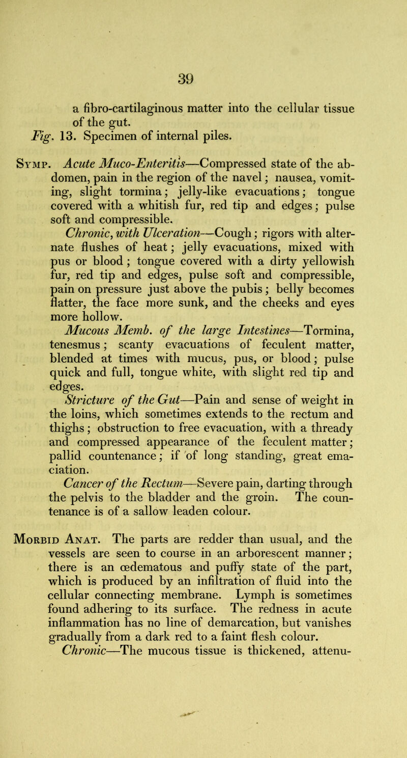 a fibro-cartilaginous matter into the cellular tissue of the gut. Fig. 13. Specimen of internal piles. Symp. Acute Muco-Enteritis—Compressed state of the ab- domen, pain in the region of the navel; nausea, vomit- ing, slight tormina; jelly-like evacuations; tongue covered with a whitish fur, red tip and edges; pulse soft and compressible. Chronic, with Ulceration—Cough; rigors with alter- nate flushes of heat; jelly evacuations, mixed with pus or blood ; tongue covered with a dirty yellowish fur, red tip and edges, pulse soft and compressible, pain on pressure just above the pubis ; belly becomes flatter, the face more sunk, and the cheeks and eyes more hollow. Mucous Memh. of the large Intestines—Tormina, tenesmus; scanty evacuations of feculent matter, blended at times with mucus, pus, or blood; pulse quick and full, tongue white, with slight red tip and edges. Stricture of the Gut—Pain and sense of weight in the loins, which sometimes extends to the rectum and thighs; obstruction to free evacuation, with a thready and compressed appearance of the feculent matter; pallid countenance; if of long standing, great ema- ciation. Cancer of the Kectum—Severe pain, darting through the pelvis to the bladder and the groin. The coun- tenance is of a sallow leaden colour. Morbid Anat. The parts are redder than usual, and the vessels are seen to course in an arborescent manner; there is an cedematous and puffy state of the part, which is produced by an infiltration of fluid into the cellular connecting membrane. Lymph is sometimes found adhering to its surface. The redness in acute inflammation has no line of demarcation, but vanishes gradually from a dark red to a faint flesh colour. Chronic—The mucous tissue is thickened, attenu-