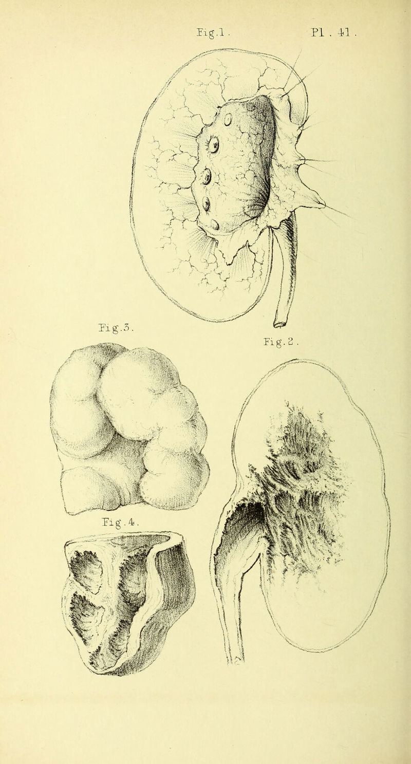 PI . 41 Iig.l .