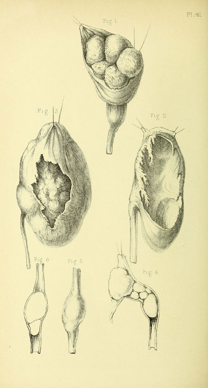 PI .42.