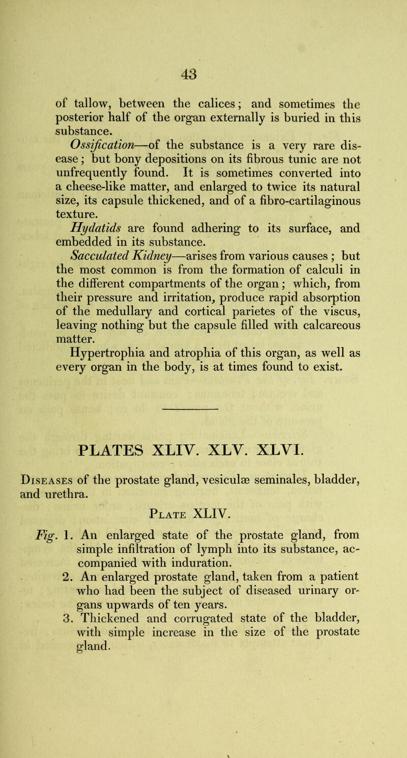 of tallow, between the calices; and sometimes the posterior half of the organ externally is buried in this substance. Ossification—of the substance is a very rare dis- ease ; but bony depositions on its fibrous tunic are not unfrequently found. It is sometimes converted into a cheese-like matter, and enlarged to twice its natural size, its capsule thickened, and of a fibro-cartilaginous texture. Hydatids are found adhering to its surface, and embedded in its substance. Sacculated Kidney—arises from various causes ; but the most common is from the formation of calculi in the different compartments of the organ; which, from their pressure and irritation, produce rapid absorption of the medullary and cortical parietes of the viscus, leaving nothing but the capsule filled with calcareous matter. Hypertrophia and atrophia of this organ, as well as every organ in the body, is at times found to exist. PLATES XLIY. XLY. XLVI. Diseases of the prostate gland, vesiculse seminales, bladder, and urethra. Plate XLIV. Fig. 1. An enlarged state of the prostate gland, from simple infiltration of lymph into its substance, ac- companied with induration. 2. An enlarged prostate gland, taken from a patient wdio had been the subject of diseased urinary or- gans upwards of ten years. 3. Thickened and corrugated state of the bladder, with simple increase in the size of the prostate gland.