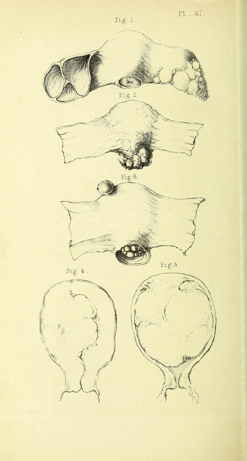 PI . 4/