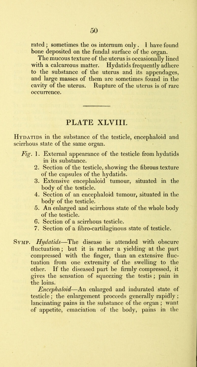 rated; sometimes the os internum only. 1 have found bone deposited on the fundal surface of the organ. The mucous texture of the uterus is occasionally lined with a calcareous matter. Hydatids frequently adhere to the substance of the uterus and its appendages, and large masses of them are sometimes found in the cavity of the uterus. Rupture of the uterus is of rare occurrence. PLATE XLVIII. Hydatids in the substance of the testicle, encephaloid and scirrhous state of the same organ. Fig. 1. External appearance of the testicle from hydatids in its substance. 2. Section of the testicle, showing the fibrous texture of the capsules of the hydatids. 3. Extensive encephaloid tumour, situated in the body of the testicle. 4. Section of an encephaloid tumour, situated in the body of the testicle. 5. An enlarged and scirrhous state of the whole body of the testicle. 6. Section of a scirrhous testicle. 7. Section of a fibro-cartilaginous state of testicle. Symp. Hydatids—The disease is attended with obscure fluctuation; but it is rather a yielding at the part compressed with the finger, than an extensive fluc- tuation from one extremity of the swelling to the other. If the diseased part be firmly compressed, it gives the sensation of squeezing the testis ; pain in the loins. Ejicephaloid—An enlarged and indurated state of testicle; the enlargement proceeds generally rapidly; lancinating pains in the substance of the organ ; want of appetite, emaciation of the body, pains in the