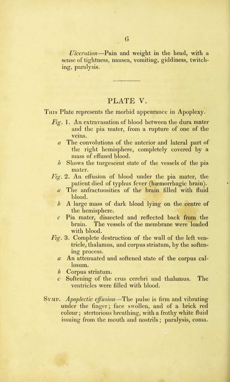 Ulceration—Pain and weight in the head, with a sense of tightness, nausea, vomiting, giddiness, twitch- ing, paralysis. PLATE V. This Plate represents the morbid appearance in Apoplexy. Fig. 1. An extravasation of blood between the dura mater and the pia mater, from a rupture of one of the veins. a The convolutions of the anterior and lateral part of the right hemisphere, completely covered by a mass of effused blood. b Shows the turgescent state of the vessels of the pia mater. Fig. 2. An effusion of blood under the pia mater, the patient died of typhus fever (hsemorrhagic brain). a The anfractuosities of the brain filled with fluid blood. b A large mass of dark blood lying on the centre of the hemisphere. c Pia mater, dissected and reflected back from the brain. The vessels of the membrane were loaded with blood. Fig. 3. Complete destruction of the wall of the left ven- tricle, thalamus, and corpus striatum, by the soften- ing process. a An attenuated and softened state of the corpus cal- losum. b Corpus striatum. c Softening of the crus cerebri and thalamus. The ventricles were filled with blood. Symp. Apoplectic effusion—The pulse is firm and vibrating under the finger; face swollen, and of a brick red colour; stertorious breathing, with a frothy white fluid issuing from the mouth and nostrils; paralysis, coma.