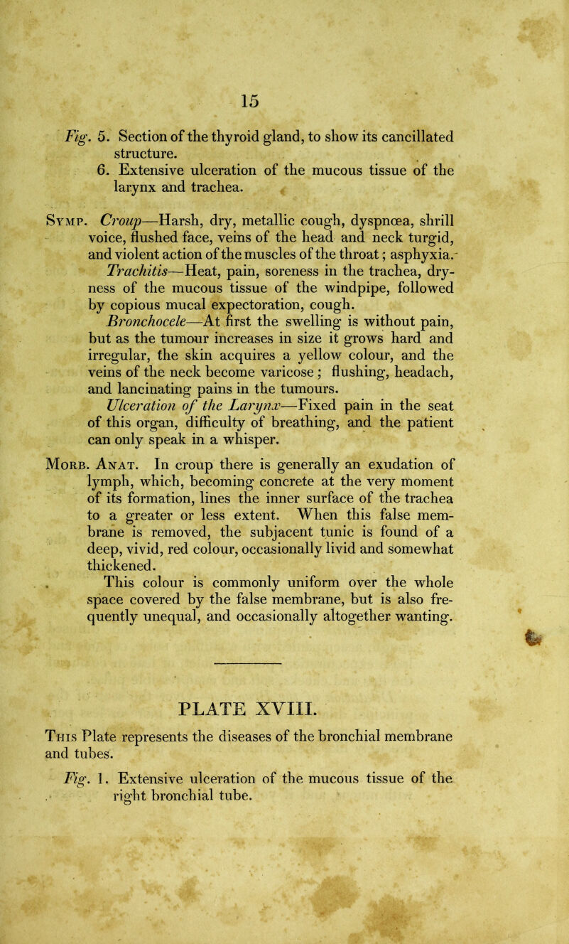 Fig. 5. Section of the thyroid gland, to show its cancillated structure. 6. Extensive ulceration of the mucous tissue of the larynx and trachea. Symp. Croup—Harsh, dry, metallic cough, dyspnoea, shrill voice, flushed face, veins of the head and neck turgid, and violent action of the muscles of the throat; asphyxia. Trachitis—Heat, pain, soreness in the trachea, dry- ness of the mucous tissue of the windpipe, followed by copious mucal expectoration, cough. Bronchocele—At first the swelling is without pain, but as the tumour increases in size it grows hard and irregular, the skin acquires a yellow colour, and the veins of the neck become varicose; flushing, headach, and lancinating pains in the tumours. Ulceration of the Larynx—Fixed pain in the seat of this organ, difficulty of breathing, and the patient can only speak in a whisper. Morb. An at. In croup there is generally an exudation of lymph, which, becoming concrete at the very moment of its formation, lines the inner surface of the trachea to a greater or less extent. When this false mem- brane is removed, the subjacent tunic is found of a deep, vivid, red colour, occasionally livid and somewhat thickened. This colour is commonly uniform over the whole space covered by the false membrane, but is also fre- quently unequal, and occasionally altogether wanting. PLATE XVIII. This Plate represents the diseases of the bronchial membrane and tubes. Fio\ 1. Extensive ulceration of the mucous tissue of the O right bronchial tube.