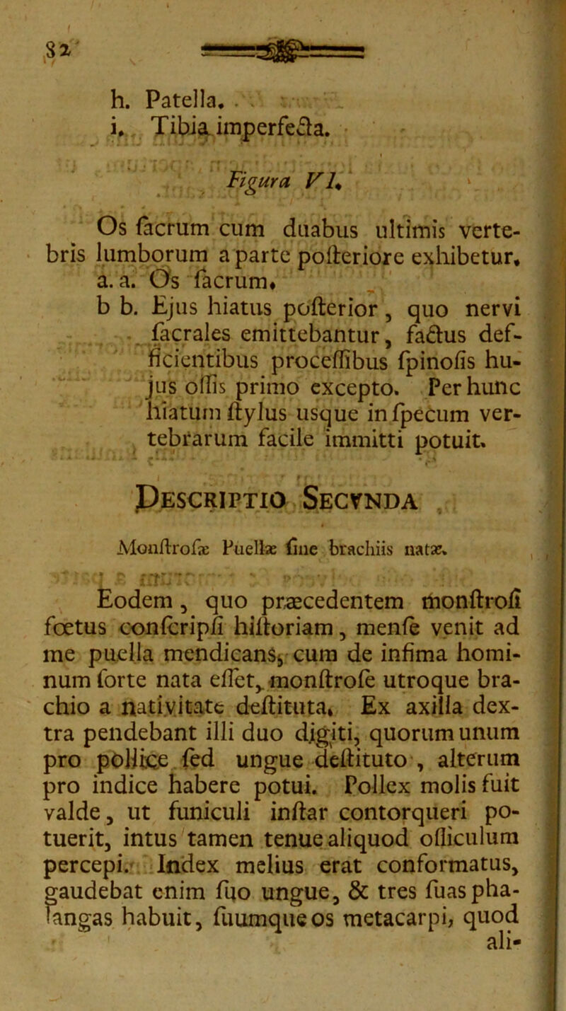 32 h. Patella. i. Tibia imperfeSa. • r • , • l Figura, V h \ Os (aerum cum duabus ultimis verte- bris lumborum a parte pofteriore exhibetur, a. a. Os facrum* b b. Ejus hiatus pofterior, quo nervi facrales emittebantur, fa&us def- ficientibus proceflibus fpinofis hu- jus ollis primo excepto. Per hunc hiatum ftylus usque infpecum ver- tebrarum facile immitti potuit. v r4, Descriptio Secvnda Monftrofae Puellas (ine brachiis nata?» rrruir: - » Eodem, quo praecedentem monftrod foetus confcripfi hiitoriam, menfe venit ad me puella mendicans*, cum de infima homi- num forte nata effet, monftrote utroque bra- chio a nativitate deftituta» Ex axilla dex- tra pendebant illi duo digiti, quorum unum pro pollice fed ungue deftituto , alterum pro indice habere potui. Pollex molis fuit valde, ut funiculi inftar contorqueri po- tuerit, intus tamen tenue aliquod olliculum percepi. Index melius erat conformatus, gaudebat enim fuo ungue, & tres fuaspha- langas habuit, fuumqueos metacarpi, quod ali-