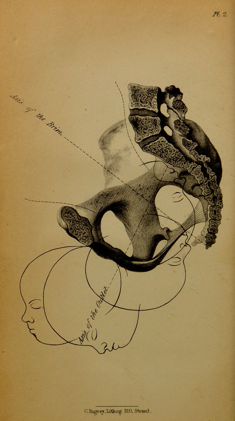 Pf , 2. (j.Tngrej. Ijthog. 310, Strand.