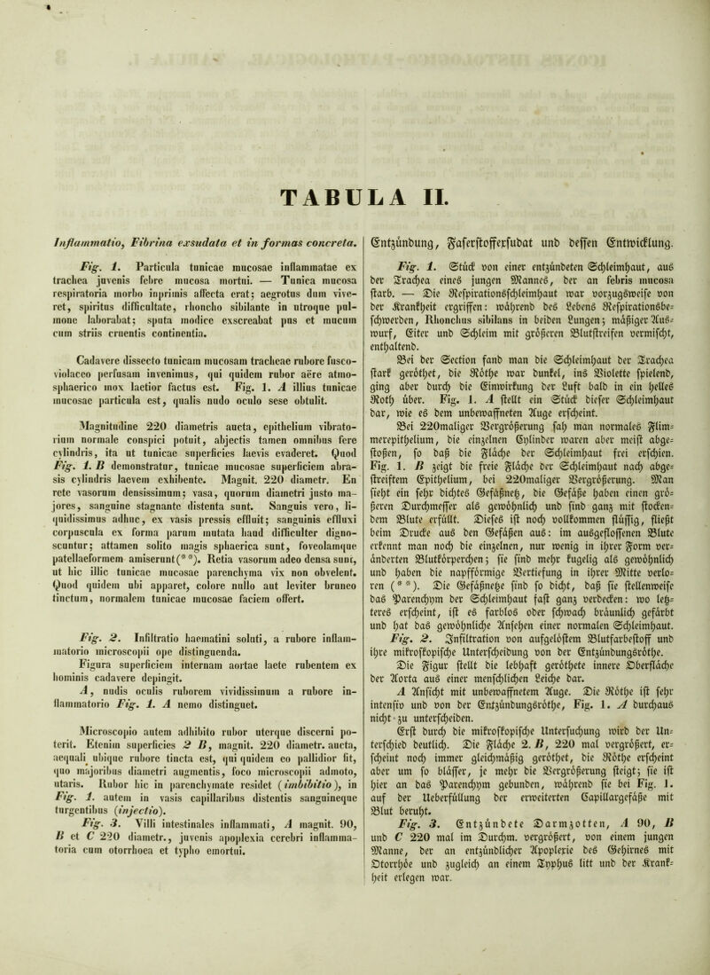 Inflammatio^ Fibrina exsudata et in formas concreta, Fig. 1. Particula tunicae mucosae inflammatae ex trachea juvenis fehre mucosa mortui. — Tunica mucosa respiratoria inorho inpriinis aflccta erat; aegrotos dum vive- ret, spiritus difficultate, rhoncho sibilante in utroque pul- mone laborabat; sputa modice exscreabat pus et mucum cum striis cruentis continentia. Cadavere dissecto tunicam mucosam tracheae rubore fusco- violaceo perfusam invenimus, qui quidem rubor aere atmo- splmerico mox laetior factus est. Fig. 1. A illius tunicae mucosae particula est, qualis nudo oculo sese obtulit. Magnitudine 220 diametris ancta, epithelium vibrato- rium normale conspici potuit, abjectis tamen omnibus fere cylindris, ita ut tunicae snj)erficics laevis evaderet. Quod Fig, 1. B demonstratur, tunicae mucosae superficiem abra- sis cylindris laevem exhibente. Magnit. 220 diametr. En rete vasorum densissimum; vasa, quorum diametri justo ma- jores, sanguine stagnante distenta sunt. Sanguis vero, li- quidissimus adhuc, ex vasis pressis effluit; sanguinis effluxi corpuscula ex forma parum mutata haud difficulter digno- scuntur; attamen solito magis sphaerica sunt, foveolamque patellaeforraem amisernnt(**). Retia vasorum adeo densa sunt, ut hic illic tunicae mucosae parenchyma vix non obvelent. Quod quidem ubi apj)aret, colore nullo aut leviter bruneo tinctum, normalem tunicae mucosae faciem oflert. Fig. 2. Infiltratio haematini soluti, a rubore inflam- matorio microscopii ope distinguenda. Figura superficiem internam aortae laete rubentem ex hominis cadavere depingit. A, nudis oculis ruborem vividissimum a rubore in- flammatorio Fig. 1. A nemo distinguet. Microscopio autem adhibito rubor uterque discerni po- terit. Etenim superficies 2 R, magnit. 220 diametr. aucta, aequali^ ubique rubore tincta est, qui quidem eo pallidior fit, quo majoribus diametri augmentis, foco microscopii admoto, utaris. Rubor hic in parenchymate residet (imbibitio), in Fig. J. autem in vasis capillaribus distentis sanguineque turgentibus {injectio). Ftg. 3. Villi intestinales inflammati, A magnit. 00, B et C 220 diametr., juvenis apoplexia cerebri inflamma- toria cum otorrhoea et typho emortui. ©ntjunbung, ^aferftoffepfubat unb beffen ©ntnjic^lung. Fig. 1. @tucf ÜOU einer entjünbeten ©dylcimbaut, au§ ber SSrac^ea eineö jungen SJJanneS, ber an febris mucosa ftarb. — 35ic SJefpirationgfdyleimljawt wat vor^ugömeife r>on ber .^ranflyfit ergriffen: mdlyrenb beö öebenö ^Refpirationöbe= fdywerben, Rhonchus sibilans in beiben ßungen; mdpiger^Cu^- murf, @iter unb ©dyleim mit groperen Stutftreifen uermifdyt, entiyattenb. «8ei ber ©ection fanb man bie S^leimlyaut ber Sradyea ftarf gerotlyet, bie 3?6tbe mar bunfel, in§ SSiolette fpielenb, ging aber burd) bie ßimnirfung ber 2uft batb in ein lyeUeg SJotl; über. Fig. 1. A fteflt ein 0tu(j' biefer 0dyleimbaut bar, mic eö bem unbemaffneten 2fugc erf(^eint. S3ei 220maliger JSergroperung fal; man normale^ Slim= merepittyelium; bie einjelnen Gplinber maren aber meift abge- fiopen, fo bap bie glddye ber ©dyteimlyaut frei erfdyien. Fig. 1. B jeigt bie freie ^Iddye ber Sdyleimtyaut nad) abge= ftreiftem gpitlyelium, bei 220maliger SSergroperung. Wlan fieiyt ein felyr bic^teö @efdpne|, bie ©efdpc tyaben einen gr6= peren 3)urcj)meffer alö gemoljnlid) unb finb ganj mit ftocfen= bem S3lute erfüllt. £)iefeg ift no(^ uoUtommen flüjfig, fliept beim S)rucfe aud ben ©efdpen au6: im auögefloffenen S3lute erfennt man nod) bie einjelnen, nur menig in iijrer S^orm ner= dnberten S5lutf6rperd)en; fte finb melyr fugelig alö gemotynlidy unb lyaben bie napfformige SSertiefung in ilyrer QJiitte nerlo= ren (**). S)ie ©efdpne^e finb fo bi^t, bap fie fieflenmeife baö ^arendypm ber «Sdyleim^aut faft gan^ oerbecfen: mo le^= tereg erfdyeint, ift eö farbloö ober fdymad) brdunlid) gefdrbt unb l;at baö gemolynlidye Tfnfelyen einer normalen ©dyleim^aut. Fig, 2. Infiltration »on aufgeloftem 93lutfarbeftoff unb il;re mifroffopifdye Unterfdyeibung oon ber (Sntjünbungärdtbe. 31)ie ^igur fteflt bie leblyaft gerotlyete innere Sberflddye ber 2forta au§ einer menfdfylidyen fieidfye bar. A 3fnfid)t mit unbemaffnetem TCuge. 2)ie 9?6tlye ift felyr intenfio unb non ber ©ntjünbungSrotlye, Fig. 1. ^ burdyauö ni^t*5u unterfdyeiben. @rft burd) bie mifroffopifdye Unterfudyung mirb ber Un^ terfc^ieb beutlic^. 2)ie glddye 2.B, 220 mal oergropert, er= fd)eint nod) immer gleit^mdpig gerotlyet, bie 9?6tbe erfdyeint aber um fo bldffer, je melyr bie SSergroperung fteigt; fie ift lyier an baö ^arendypm gebunben, mdlyrenb fie bei Fig. J. auf ber Ueberfüflung ber erweiterten (Sapiflargefdpe mit Sölut berulyt. Fig. 3. ©ntjünbete ^arm^otten^ A 90, B unb C 220 mal im ^urdym. oergropert, oon einem jungen SJtanne, ber an entjünblidyer 2fpoplerie beS ©e^irneö mit Ötorrlyoe unb jugleidy an einem Spp^uö litt unb ber Äranf= lyeit erlegen war. ✓