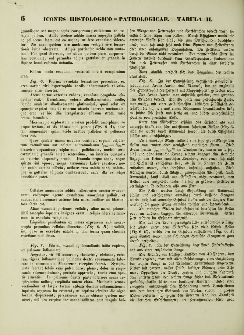 ;5ranulis(jGe sat magna copia conspersam; cellularnm ne ve- I stigia quidem. Acido acetico addito massa amorpha pallida | ac pellucens facta est eo usque, ut fere evanuisse videre- tur. Ne nunc quidem sive nucleorum vestigia sive forma- tionis iuitia observata. Adipis particulae acido non muta- tae. Pus quod dixerant, ne ullum quidem puris corpuscu- lum continuit, sed permulta adipis guttulas et granula in liquore haud colorato natantia. Eodem modo coagulum ventriculi dextri comparatum erat. Ftg. 6. Fibrina exsudata formatione procedens, ex areo aortae viri hypertrophia cordis inflammatoria valvula- rumque vitiis emortui. xVrcus aortae exterius rubens, exsudato coagulato ob- ductus erat. Exsudatum, coloris alboflavescentis, molle, liquido madebat alboflavescente glutinosiori, quod velut ex spongia exprimi potuit; ceterum attactu tenerum unctuosum- que erat, et hic illic irregulariter elFusum strata varie crassa formabat. Microscopio exploratum massam prodidit amorpham, eo usque textam, ut vix fibrosa dici posset {Ftg. 6 A), quae tam amraoniaco quam acido acetico pallidior et pellucens facta est. Quae quidem massa magnam continuit copiam cellula- rum rotundarum aut saltem subrotundarum Y200 — diametro aequantium, utplurimum pallidarum, nucleis veris carentium; granulis autem scatentium, an interius contentis an exterius adspersis, nescio. Granula neque aqua, neque spiritu vini aquoso, neque ammoniaco kalive caustico, ne- que acido acetico affecta, aethere vero soluta sunt, soluta- que in guttulas adiposas confluxerunt, nude illa ex adipe constitisse patet. Cellulae ammoniaco addito pallescentes sensim evanue- runt; eodemque agente exsudatum amorphum palluit, et continuata ammoniaci actione tota massa mollior ac filamen- tosa facta est. Aliae exsudati portiones cellulis, aliae massa primor- diali amorpha inprirnis insignes erant. Adipis liberi ne mini- mum in exsudato vestigium. Liquidum purulentum ex massa expressum sub micro- scopio permultas cellulas discretas {Fig. 6*. B) prodidit, iis, quae in exsudato natabant, tam forma quam chemica reactione simillimas. Fig. 7. Fibrina exsudata, formationis iuitia capiens, ex pulmone inflammato. Aegrotus, vir 40 annorum, rhedarius, ebriosus, cete- rum vigens, inflammatione pulmonis dextri consummata labo- rans in nosocomium Monacense receptus fuerat. Sympto- mata fuerant febris cum pulsu duro, pleno, dolor in respi- rando veheraentissimus, pectoris oppressio, tussis cum spu- tis cruentis. In pulmonis dextri parte inferiore sonus re- spiratorius nullns, crepitatio autem clara. Medicatio venae- sectionibus et largis tartari stibiati dosibus inflammationem inprirnis aggressa ita cesserat, ut septimo circiter die signa localia disparerent, percussionis sonus obtusus quidem ma- neret, sed pro crepitatione sonus adflatus cnm magnis hul- I fen 9Kenge non ^etttropfen unb gettforni^en bebecft mar; fie I enthielt feine ©pur non Seifen. Sur(^ ©ffigfdure mürbe bie amorphe SJtaffe fe^r blap, big jum S5erfd)minben burd)fd)ei= nenb; man faf) au^ je^t nod) feine ©puren non Sellenfernen ober einer anfangenben Srganifation. S5ie g^etttf^eile mürben bur^ bie ©durc nid)t nerdnbert. £»er nermeintli(^c @iter im Innern entljielt bur^auö feine ßiterfdrperd^en, fonbern nur fe^r niele ^etttropfen unb ^ettf6rnd)en in einer farblofen Slüfftgfeit. ©anj d^nlic^ ner^ielt fic^ bag ßoagulum beg rechten SSentrifelg. Ftg, 6. Sn ber ©ntmidfelung begrijfeneg g^aferfloffer= fubat, nom Arcus Aortae eineg 59?anneg, ber an entjunbli= (^er i^ppertrop^ie beg .^erjeng mit .^lappenfefjlern geftorben mar. 3)er Arcus Aortae mar duperlid) gerdt^et, mit gerönne^ nem ©rfubate bebecft. SDaffelbe ^atte eine gelblicl)meipe §arbe, mar meid), mit einer gelblid)meipen, bi(flicl)en gluffigfeit ge= trdnft, bie ftef) mie aug einem ©d)mamme ^eraugbruefen liep; eg fül)lte ftd) fanft unb fettig an, unb bitbete unregelmdpigc Partien non 5iemlid;er 2)i(fe. Unter bem SKifroffope erfd)ien bag ©rfubat alg eine amorpl)^ SWajfe non fe^r unbeftimmt faferigem ©efuge (Fig. ö. A)'y fie mürbe bur^ 2fmmoniaf fomoI)t alg burd; ©fftgfdure btdffer unb burd)fic^tiger. S^iefe amorp()e 9Kaffe entt)iett eine fe^r grope S!)?enge non Sellen non runber ober menigfteng runblicl)er §orm. ®iefc Sellen Ratten 7.200 — Vioo' im S)ur^meffer, maren meift fef)r blap unb o^ne beutlid;e .^erne; jeigten bagegen eine jiemlid^c 2(nja^l non fleinen runblic^en Äornc^en, non benen fid) nic^t mit ©id)erl)eit entfe^eiben liep, ob fie im Snnern ber Sellen enthalten maren, ober benfelben duperlid^ auffapen. ®iefe Äornc^en mürben burd) SßSaffer, gem6^ntid)en Sßeingei)!, faufi. Tfmmoniaf, fauft. .tati unb ©fftgfdure nic^t nerdnbert, non 2letl)er aber aufgeloft, mobei fie fi(^ ju groperen g'etttropfen nereinigten j fie beftanben atfo aug g^ett. S)ie Sellen mürben burd) S3e^anblung mit 2(mmoniaf blaffer unb nerf(^manben allmdlig; burc^ baffelbe 9?eageng mürbe aud^ bag amorphe ©rfubat blaffer unb bei tdngerer @in= mirfung bie ganje SO^affe allmdlig meii^er unb fabenjief)enb. 2ln mancl)en ©teilen beg ©rfubateg berrfcl)ten bie Sellen nor, an anberen bagegen bie amorpl)e ©runbmaffe. greieg gett erfd)ien im ©rfubate nirgenbg. ^ie aug ber SKaffc f)erauggebru(fte eiterdl)nti(^e Siüffifl* feit geigte unter bem SÖlifroffop fet)r niele ifolirte Sellen (Fig. 6. .ß), melcl)e ben im ©rfubate entl;altenen (Fig. 6. A) gang dt)nlic^ maren unb fiel) gegen cl)emifcf)e 3?eagentien gang ebenfo nerl)ielten. Fig. 7. Sn ber ©ntmicflung begriffeneg gaferftofferfu= bat aug einer entgunbeten 8unge. ®er .Äranfe, ein frdftiger Äutfe^er non 40 Saufen, bem Srunfe ergeben, mar mit allen ©rfcj)einungen einer ©ntgunbung ber red)ten ßunge in bag SD?üncl)ner .^ranfen^aug eingetreten, lieber mit l)artem, nollen ^utfe, f;eftiger ©cl)merg beim 2ftl)= men, SDppreffion ber S3rujl, .^uften mit blutigem 2fugmurf. Sm unteren Siteit ber recl)ten Cungc fel)ltc bag 9?efpirationg= gerduf(^, bafur l)drte man beuttid)eg .^niftern. Unter einer energif(^en antipl)logiftifcl)en 93e^anblung burc^ SSendfectionen unb bem innerlichen ©ebraucl) non Tartar, stibiat. in gropen £)ofen nertoren fidf) gegen ben fiebenten SSag ber .^ranfl)eit I bie ortli^en @rfd)einungen; ber ^ercuffiongton blieb gmar