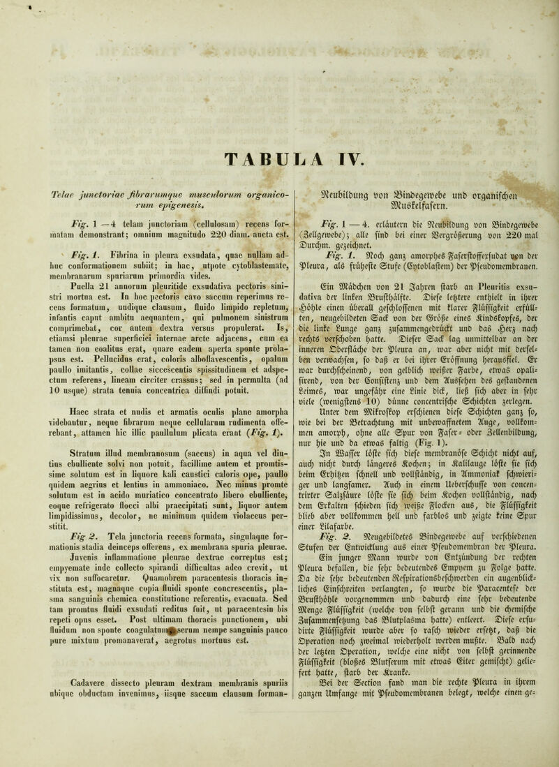 Telae junctonac fihrarumque musculorum organico- rum epxgenesis, Fig. 1 —4 telam jimctoriam (cellulosam) recens for- matam demonstrant; omnium magnitudo 220 diam, aucta est. ' Fig. 1. Fibrina in pleura exsudata, quae nullam ad- huc conformationem subiit; iu bac, utpote cytoblastemate, membranarum spuriarum primordia vides. Puella 21 annorum pleuritide exsudativa pectoris sini- stri mortua est. In hoc pectoris cavo saccum reperimus re- cens formatum, undique clausum, fluido limpido repletum, infantis caput ambitu aequantem, qui pulmonem sinistrum comprimebat, cor notem dextra versus propulerat. Is, etiamsi pleurae superficiei internae arcte adjacens, cum ea tamen non eoalitus erat, quare eadem aperta sponte prola- psus est. Pellucidus erat, coloris alboflavescentis, opalum paullo imitantis, collae siccescentis spissitudinem et adspe- etnm referens, lineam circiter crassus; sed in permulta (ad 10 usque) strata tenuia concentrica diffindi potuit. Haec strata et nudis et armatis oculis plane amorpha videbantur, neque fibrarum neque cellularum rudimenta offe- rebant, attamen hic illic paullulum plicata erant {Fig. 1). Stratum illud membranosum (saccus) in aqua vel diu- tius ebulliente solvi non potuit, facillime autem et promtis- sime solutum est in liquore kali caustici caloris ope, paullo quidem aegrius et lentius in ammoniaco. Nec minus promte solutum est in acido muriatico concentrato libero ebulliente, eoque refrigerato flocci albi |)raecipitati sunt, liquor autem limpidissimus, decolor, ne minimum quidem violaceus per- stitit. Fig 2. Tela junctoria recens formata, singulaque for- mationis stadia deinceps offerens, ex membrana spuria pleurae. Juvenis inflammatione pleurae dextrae correptus est; empyemate inde collecto spirandi difficultas adeo crevit, ut vix non suffocaretur. Quamobrem paracentesis thoracis in- stituta est, magnaque coj)ia fluidi sponte concrescentis, pla- sma sanguinis chemica constitutione referentis, evacuata. Sed tam promtus fluidi exsudati reditus fuit, ut paracentesin bis repeti opus esset. Post ultimam thoracis j)unctionem, ubi fluidum non sponte coagulatuml^erum nempe sanguinis pauco pure mixtum promanaverat, aegrotus mortuus est. Cadavere dissecto pleuram dextram membranis spuriis ubique obductam invenimus, iisque saccum clausum forman- 9leub{fbunfl bon ^inbcfleiuebe unb erganifeben S)hiöfelfafcrn. Fig. 1 — 4. crfdutern bie 0^eubi(bung non SSinbegemebe (3eflflftt>ebe); aUc ftnb bei einer SSergroperung non 220 mal ^ur(bm. gejeidynet. Fig. 1. 9Zod) ganj amorpf)e6 ^aferj^offerfubat upn ber §)leura, al§ frul;effe @tufe ((Sptoblajfem) ber ^feubomembranen. @in SÄdbd)en non 21 Sauren jfarb an Pleuritis exsu- dativa ber linfen S3rujlf)dlfte. £>iefc festere enthielt in ihrer i^ohle einen überall gefchloffenen mit flarer ^lufffgfeit erfüll^ ten, neugebilbeten «Saef non ber ©rope eines ÄinbSfopfeS, ber bie linfe Sungc ganj jufammengebrudft unb baS .^erj na(b redhtS nerfchoben hatlf- tiefer @acf lag unmittelbar an ber inneren £)berflddhe ber pleura an, mar aber nicht mit berfeU ben nermachfen, fo bap er bei ihrer Eröffnung h^i^^^uSfiel, @r mar burdhf<heinenb, non gelblich meiper ^arbe, etmaS opali= firenb, non ber ßonfiffenj unb bem TfuSfehen beS geffanbenen SeimeS, mar ungefdhr eine Sinie bief, liep ftch aber in [ehr niele (menigftenS 10) bunne concentrif(he ©dhidyten jerlegen. Unter bem SKifroffop erf^ienen biefe ©chidhten gan3 fo, mic bei ber 33etrachtung mit unbemaffnetem 3fuge, notlfom= men amorph, ©pur non ^afer= ober 3ellenbilbung, nur hi« etmaS faltig (Fig. 1). Sn 2öaffer lofie ftch ^i«f« membranofe ©chidyt nicht auf, audh nidht burch IdngereS .^0(hen; in .Kalilauge lofie fte fi^ beim ©rhi^en fchnell unb nollfidnbig, in 2fmmoniaf fdhmieri= ger unb langfamer. 2fudh in einem Ueberfchuffe non concen= trirter ©aljfdurc lojle fte fidh beim Äochen nollfidnbig, nach bem ©rfalten fchieben [ich meipe bie glüfftgfeit blieb aber nollfommen h«fi unb farblos unb jeigte feine ©pur einer l?ilafarbe. Fig. 2. ^feugebilbeteS S3inbegemebe auf nerfdyiebenen ©tufen ber ©ntmidlung auS einer ^feubomembran ber ^^leura. @in junger 9)fann mürbe non ©ntjunbung ber red;ten pleura befallen, bie fehr bebeutenbeS ©mppem ju §olge h^tte. k)a bie fefir bebeutenben SfefpirationSbef^merben ein augenblicf; licheS @inf(hreiten nerlangten, fo mürbe bie ^aracentefe ber S3ruflhdhl« norgenommen unb baburdh eine fel;r bebeutenbe 9)?enge ^lufftgfeit (melche non felbfi gerann unb bie (hemifche Sufammenfe^ung baS 93lutplaSma h^tte) entleert. ^Diefe erfu= birte ^lufffgfeit mürbe aber fo rafch mieber erfe^t, bap bie Operation nody jmeimal mieberholt merben mupte. 25alb nach ber leisten Operation, meldpe eine nicht non felbfi gerinnenbe Slufftgfeit (blopeS SSlutferum mit etmaS (Siter gemifcht) gelie= fert hutte, fiarb ber Äranfe. S3ei ber ©ection fanb man bie rechte pleura in ihrem ganzen Umfange mit ^feubomembranen belegt, melch« einen ge=