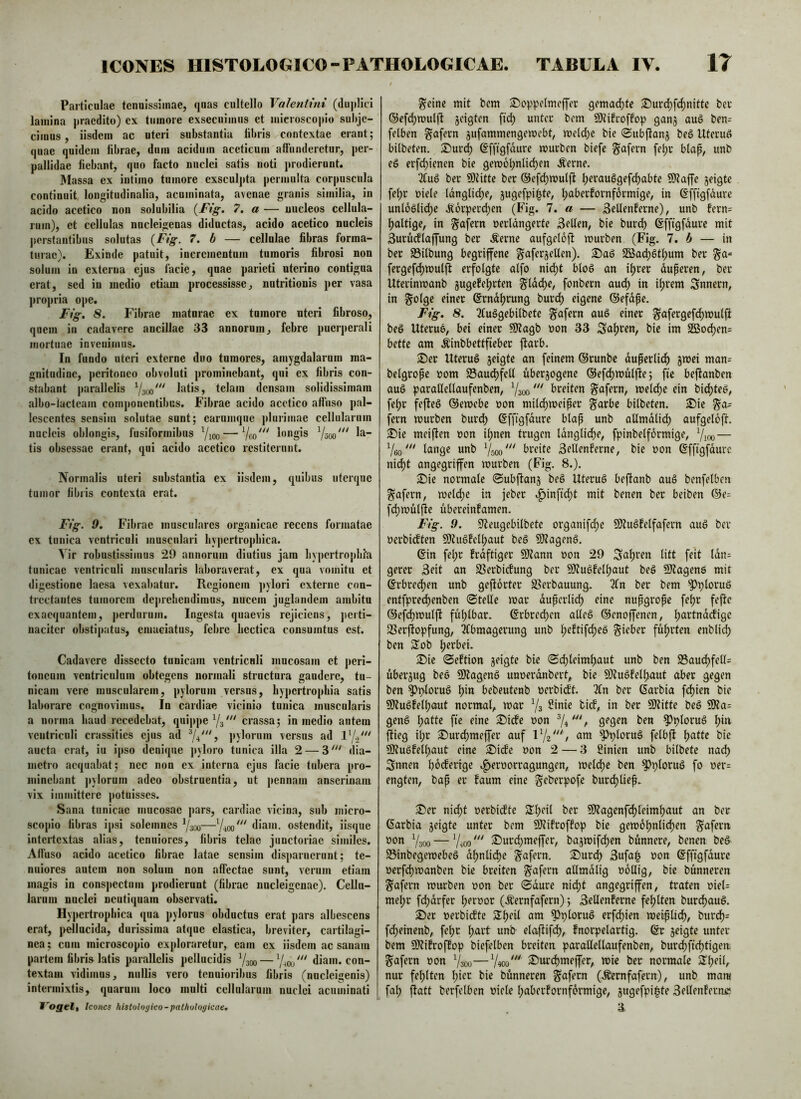 Particulae tenuissimae, quas cultello Valentini (duplici lamina praedito) ex tumore exsecuimus et microscopio subje- cimus , iisdem ac uteri substantia libris contextae erant; quae quidem librae, dum acidum aceticum affunderetur, per- pallidae fiebant, quo facto nuclei satis noti prodierunt. Massa ex intimo tumore exsculjda permulta corpuscula continuit longitudinalia, acuminata, avenae granis similia, in acido acetico non solubilia {Fig. 7. a — uucleos cellula- rum), et cellulas nncleigenas diductas, acido acetico nucleis perstantibus solutas {Fig. 7. h — cellulae fibras forma- turae). Exinde patuit, incrementum tumoris fibrosi non solum in externa ejus facie, quae parieti uterino contigna erat, sed in medio etiam processisse, nutritionis per vasa propria ope. Fig, 8. Fibrae maturae ex tumore uteri fibroso, quem in cadavere ancillae 33 annorum, febre puerperali mortuae invenimus. In fundo uteri externe duo tumores, amygdalarum ma- gnitudine, peritoneo obvoluti prominebant, qui ex fibris con- stabant parallelis latis, telam densam solidissimam albo-lacteam componentibus. Fibrae acido acetico affuso pal- lescentes sensim solutae sunt; earumque jdurimae cellularum nucleis oblongis, fusiformibus Yioo—longis tis obsessae erant, qui acido acetico restiterunt. Normalis uteri substantia ex iisdem, quibus iitcrque tumor fibris contexta erat. Fig. 9, Fibrae musculares organicae recens formatae ex tunica ventriculi musculari hypertrophica. Vir robustissimus 29 annorum diutius jam liypcrtroj)bi'a tunicae ventriculi muscularis laboraverat, ex qua vomitu et digestione laesa vexabatur. Regionem pylori externe con- trectantes tumorem dc|)rebcndimns, nucem juglandem ambita exaequantem, j)crdurum. Ingesta quaevis rejiciens, ])citi- naciter obstipatus, emaciatus, febre liectica consumtus est. Cadavere dissecto tunicam ventricnli mucosam et j)cri- toncum ventriculum obtegens normali structura gaudere, tu- nicam vere muscularem, pylorum versus, hypertrophia satis laborare cognovimus. In cardiae vicinio tunica inuscnlaris a norma haud recedebat, qui|>pe crassa; in medio autem ventriculi crassities ejus ad Y^^^S pylorum versus ad .aucta erat, iu ipso denique jtyloro tunica illa 2 — 3'^' dia- metro aequabat; nec non ex interna ejus facie tubera ]>ro- minebant pylorum adeo obstruentia, ut pennam anserinam vix immittere potuisses. Sana tunicae mucosae j)ars, cardiae vicina, sub micro- scopio fibras ipsi solemnes Ysoo—Y400''' diam, ostendit, iisque intertextas alias, tenuiores, fibris telae junctoriac similes. Alluso acido acetico fibrae latae sensim disjtaruerunt; te- nuiores autem non solum non affectae sunt, verum etiam magis in conspectum prodierunt (fibrae nacleigcnac). CcUu- laruni nuclei neutiquam observati. Hypertrophica qua pylorus obductus erat pars albescens erat, j>ellacida, durissima atque elastica, breviter, cartilagi- nea; cum microscopio exploraretur, eam ex iisdem .ac sanam partem fibris latis par.allclis pellucidis Ysoo — Y^oü^^^ diam, con- textam vidimus, nullis vero tenuioribus fibris (nucleigenis) intermixtis, quarum loco multi cellnlaruin nuclei acuminati foQelt leones histoloyico-pathologicae. ^cine mit bcm ^oppdmcffer gemad()te 2)ur(^fc^nitte bei' ©cfdymuljf jeigten fic^ unter bcm 9)rifroffop gan§ aug ben= felben ^afern jufammengemcbt, meldye bie ©ubflanj beö Uteruö bilbeten. S)urd) ©ffigfdure murben biefe ^afern fe^r blap, imb eö erfe^ienen bie gemoiyntic^en .^erne. 2fu§ ber 9)Jitte ber ®cf(^mut|it lyerauSgefc^abte SO^affe jeigte fe^r nide Idnglidye, jugefpi^te, Ijaberfornformige, in ßfftgfdure untoöliepe Äorperc^en (Fig. 1. a — 3eUenferne), unb fern= l)altige, in §afern nerldngerte Selten, bie burd) ßfftgfdure mit Surücflaffung ber Äerne aufgdoft mürben (Fig. 1, b — in ber S3ilbung begriffene gaferjeUen). 2öad)6tl)um ber §a= fergefd)mul|t erfolgte alfo nid)t bloß an itjrer duperen, ber Uterinmanb jugefet)rten fonbern aud) in iprem Snnern, in ©rndljrung burd) eigene ©efdpe. Fig, 8. 3(u§gebilbetc ^afern au6 einer ^afergefd)mul|i beS Uterue, bei einer 50?agb non 33 Sapren, bie im Sßod)en= bette am Äinbbettfieber flarb. ^er Uteruö jeigte an feinem ©runbe duperlid^ jmei man= belgrope nom S3aud)fell überzogene ©efcpmülpie; fte beftanben auö parallellaufenben, Yaoo''' breiten ^afern, meld)e ein bid)teg, fel)r fefleö ©emebc non mild)meiper g^arbe bilbeten. Sie ga- fern mürben burdf) ßffigfdure blap unb allmdlid) aufgeloft. Sie meiflen non ipnen trugen ldnglid)e, fpinbelformige, YlOO Yeo' lß»9« wnb Ysoo''' breite Sdlenferne, bie non ßfftgfdurc ni^t angegriffen mürben (Fig. 8.). Sie normale ©ubftanz beö Uteruö beflanb au§ benfelben ^afern, melcl)e in jeber .^inficl)t mit benen ber beiben ©e= fcl)mülffe Übereinfamen. Fig. 9. S^eugebilbete organifd)e 9)ZuSfelfafern auö ber nerbieften 9)tuSfell)aut beS SKagenS. 6in felyr frdftiger 9)?ann non 29 S«l)i*en litt feit ldn= gerer 3eit an SSerbiefung ber Sltuöfelpaut beg SlJagenö mit @rbred)en unb geftorter SSerbauung. Tfn ber bem ^ploruö entfpreepenben (Stelle mar dupcrlicl) eine nupgrope fepr feffe ®effcf)mulft fül)lbar. @rbred)cn alles ©enoffenen, l)artnd(figc SSerftopfung, Qfbmagerung unb l)eftifcl)eö lieber führten enblicl) ben SJob l)erbei. Sie Seftion zeigte bie Sci)leim^aut unb ben 25aud)fell= Überzug beS 9)fagenS unnerdnbert,. bie Si)tuSfell)aut aber gegen ben ^lyloruS I)in bebeutenb nerbieft. 21n ber ßarbia fcl)ien bie 9ÄuSfell)aut normal, mar Ys 9)titte beS 9Ra= genS I)atte fte eine Sitfe non Yv 9^9^ii ben ^^ploruS I;in flieg il;r Surcl)meffer auf IY2'/ ^ploruS felbft l)attc bie 9RuSfell)aut eine Siffe non 2 — 3 Sinien unb bilbete nacl) Snnen fioeferige .|>ernorragungen, meld)c ben ^ploruS fo ner= engten, bap er faum eine ^eberpofe burd)liep. Ser nidyt nerbiefte 5ll)eil ber 9)lagenfc^leim{)aut an ber ©arbia zdgte unter bem SUrifroffop bie gemdl)nli(^en ^aferti Ysoo — Y^ioo Sur(^meffer, bazmifcl)en bünnere, benen beS SöinbegemebeS d^nlit^e ^afern. Surd) 3ufaip non ©fftgfdurc nerfcl)manben bie breiten ^afern allmdlig nollig, bie bünneren S'afern mürben non ber Sdure nicl)t angegriffen, traten nieU mepr fdydrfer l)ernor (Äernfafern); Bellfnfernc fel)lten burd)auS. Ser nerbiefte Speil am ^ploruS erf^ien meiplid), burd)= fcl)einenb, fe^r l)art unb elaflifcl), fnorpelartig. ©r zeigte unter bcm Sldfroffop biefelben breiten parallellaufenben, burcl)fief)tigeni ^afern non Ysoo—Y«)o' Surcl)meffer, mie ber normale Speil, nur fel)lten lyier bie bünneren ^afern (.^ernfafern), unb mant fat) flatt berfelbcn nide lyaberfornformige, zwgffpi^te 3dlenfecn£! ä