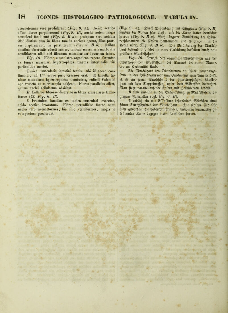 avenaeformes sese prodiderant {Fig. 9, A). Acido acetico aftbso fibrae perpallueront {Fig. 9. B), nuclei autem magis conspicui facti sunt {Fig. 9, B a); postquam vero acidum illud diutius cum in fibras tum in nucleos egerat, illae pror- sus disparuerunt, lii perstiterunt {Fig, 9. B b). Quibus omnibus observatis edocti sumus, tunicae muscularis morbosam conditionem nihil nisi fibrarum muscularium luxuriem fuisse. Fig, 10. Fibrae musculares organicae recens formatae cx tunica musculari hypertrophica tractos intestinalis viri j)eritonitide mortui. Tunica muscularis intestini tenuis, nbi id coeco con- tinuatur, ad 1usque justo crassior erat. A lamella tu- nicae muscularis hypertrophicae tenuissima, cultelli Valentini ope resecta ct microscopio subjecta. Fibras parallelas olfert, quibus nuclei cellularum obsident. B Cellulae fibrosae discretae in fibras musculares trans- iturae (Cf. Fig, 6. B). C Frustulum lamellae ex tunica muscnlari exsectae, acido acetico irroratum. Fibrae perpallidae factae sunt, nuclei vero avenaeformes, hic illic vermiformes, magis in conspectum prodierunt. (Fig. 9. A). S)urc^ 93cf)anblung mit (Sffigfdurc (Fig. 9. B) mürben bie g^afern fe^r btap, unb bie Äerne traten beutU(^er ferner (Fig. 9. B a). 9Jad) tangerer ginmirfung ber ©dure nerfd)manben bie ^afern noUfommen unb eö blieben nur bie Äerne übrig (Fig. 9. B h). S)ie SSerdnberung ber 5Öiu§feU ^aut beftanb atfo bloö in einer SSerbiebung beffelben burd) neu= gebitbete 9}?u6feifafern. Fig, 10. 9^eugebilbete organifclje 9)iu6feifafern auö ber ^ppertrop^ifct)en 9)?u6fet^aut beö Sarmeö bei einem SDtanne, ber an ^eritonitiö ftarb. 2^ic 9)?uöfel^aut beö S)ünnbarme§ an feiner Uebergangö^ jtelle in ben 93linbbarm mar jum 25ur(^meffer einer IHnie »erbi(ft. A ijb ein feiner S)urd)fd)nitt ber ]^ppertrop^if(^en S0?u6fel= ^aut mit bem S5oppetmeffer, unter bem SDtifroffop betrachtet. S!)?an fteht paralleltaufenbc gafern mit Sellenfernen bebeeft. B finb einjetne in ber (Sntmicfelung ju SÄuäfelfafern be= griffenc ^aferjellen (ngt. Fig. 6. B). C enbli(^ ein mit ©fftgfdurc behanbetteö (Stuefe^en eineö feinen £>urchfi^nitteg ber Sölu§fel(;aut. ®ie gafern finb fel;r blap gemorben, bie h^berfornformigen, bigmeiten murmartig ge= frümmten .^erne bagegen treten beutli^er lyernor.