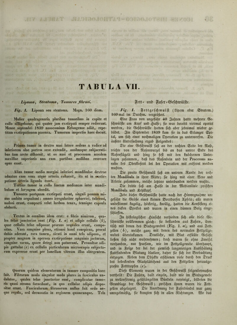 Lt2)oma, Steatoma, Tumores fibrosi, Ftg. 1. Lij)oma seu steatoma. Maga. 160 diam. Mulier quadragenaria pluribus tumoribus in capite et collo affligebatur, qui quater jam exstirpati semper redierant. Mense septembri 1839 nosocomium Erlangense adiit, repe- titam exstirpationem passura. Tumorum inspectio haec docuit. Primus tumor in dextro nasi latere sedens a radice ad inferiorem .alae partem sese extendit, ossibusque subjacenti- bus tam arcte a'dhaesit, ut os nasi et processum nasalem maxillae superioris una cum partibus moUibus resecare opus esset. Alius tumor medio margini inferiori mandibulae dextrae adnatus cum vena atque arteria cohaesit, ita ut in exstir- patione arteria liganda esset. Tertius tumor in collo lineam medianam inter mandi- bulam et laryngem obsedit. Tumores postquam exstirpati erant, singuli pomum mi- nus .ambitu aequabant j omnes irregulariter sphaerici^ tuberosi, nodosi erant, compacti velut lardum tenax, tenuique capsula obducti. Textas in omnibus idem erat; e fibris nimirum, qua- les telae junctoriae sunt {Fig. 1. a) et adipis cellulis (6), quae cellulis telae adiposae prorsus aequales erant, compo- situs. Vasa sanguine plena, etiamsi haud conspicua, procul dubio aderant, rara tamen, sicuti in omni tela adiposa, et propter magnam in operosa exstirpatione sanguinis jacturam, sanguine vacua, quare detegi non potuerunt. Permultae adi- pis guttulae (c) ex cellulis particularum microscopio subjecta- rum expressae erant per lamellam vitream illas obtegentem. Quorum quidem elementorum in tumore compositio haec fuit. Fibrarum modo singulae modo plures in fasciculos un- dulatos, quales telae junctoriae sunt, comjjlicatae tumo- ris quasi stroma formabant, in quo cellulae .adipis dispo- sit.ae erant. Fasciculorum fibrosorum nullus fuit ordo ne- que regula, sed decussatio in regionem quamcunque. Tela ^etts unb ^afer = @efc^n?ulfle. FYg. 1. ^ett9efd)mulft (fiipom ober 0teatom.) 160 mal im Surc^m. oergropert. (Sine §rau non ungefähr 40 Sagten ^atte mehrere ©e= fc^wulj^e am Äopf unb .^alfej fte mar bereite oiermal operirt morben, bie ©efdjwulfite l;atten fic^ aber jebeSmal mieber ge= bilbet. Sni 0eptember 1839 fam fie in ba§ ©rlanger 0pi= tat, um fici) einer nod^maligen £)peration ju untermerfen. £iic dupere Unterfuc^ung ergab golgenbeä: S)ie eine @efd;mulft fap an ber redyten 0eite ber 0Jofe, reichte oon ber 91afenmurjet bid an bad untere (Snbe bed S^afenflugelg unb l;ing fo feft mit ben fnodyernen Unter= lagen jufammen, bap bag S^afenbein unb ber Processus na- salis beg £)berfieferg bei ber £)peration mit entfernt werben mupten. 2)ie jweite ®ef(^wuljl fap am unteren 9?anbe ber red;= ten Mandibula in i^rer SJtittej fie l;ing mit einer SSene unb Tfrterie jufammen, welche le|tere unterbunben werben mupte. 2)ie britte fap am .^alfe in ber SOiebianlinie jwifc^en Mandibula unb Äe^lfopf. Sebe biefer (Sefc^wülfie l)atte nad) ber .^inwegnal;me un= gefd^r bie ©rdpe eineg fleinen SSorgborfer ^fpfelgj alle waren unbefiimmt fugetig, lyod’erig, fnollig, Ratten bie i;onftfienä ei= neg biefen 0pecfeg unb waren in einen bunnen 23alg einge= f(^toffen. Sn l)iftologifd)er .^inftd)t uerbielten fid) alle biefc (Sie:: fd^wüljle oollfommen gleidp: fie be^anben aug ^afern, iben- tif(^ mit benen beg S3inbegewebeg (Fig. 1. a), unb aug §ett= seilen (b), welche gans mit benen beg normalen §ettsellge= webeg Übereinfamen. S)eutlid)e, mit S3lut erfüllte ©efdpc liepen fid) nid)t wa^rnelymenj bod; waren fie ol;ne 3weifel oorl;anben, nur fparfam, wie im gettjellgewebe überljaupt, unb in golge ber bei ber siemlid^ langwierigen 2(ugfd)dlung ftattfinbenben Blutung blutleer, baper fie fic^ ber S3eobac^tung entjogen. Sieben bem Dbjefte erfd)ienen oiele burd; ben ®rucf beg bebe(fenben ®lagp(dttd)eng aug ben ^ettjellen l;eraugge= prepte ^etttropfen (c). S)iefc ©iemente waren in ber ®efd)Wulft fotgenbermapen oertl)eilt: S)ie ^afern, halb einjeln, halb wie im S3inbegewebc ju wellenförmig gefd)ldngelten Sünbeln oereinigt, bilbeten bie ©runblage ber (SJefcpwuljl; jwifdyen i(;nen waren bie ^ett= seilen abgelagert. £)ie 3fnorbnung ber g'aferbünbel war gans unregelmdpig, fie freusten fic^ in allen SJidytungen. Sßo bag