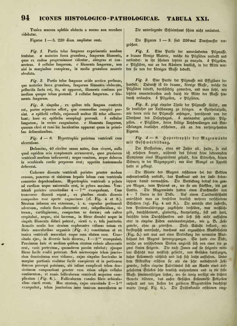 Tunica mucosa aphtbis obducta a norma non recedere videbatur. Figurae 1—3. 220 diam, ampliatae sunt. Fig. 1. Portio telae fnngosae experimentis nondnm tentatae. a materies fusca granulosa, fungorum filamenta, quae ex eadem progerminasse videntur, obtegens et con- nectens. b cellulae fungorum, c filamenta fungorum, non nisi in marginibus conspicua, in medio granulosa macerie obvelata. Ftg. 2. Portio telae fungosae acido acctico perfusae, quo materies fusca granulosa, fungorum filamenta obducens, pellucida facta est, ita, ut appareat, filamenta continua per mediam quoque telam protendi, b cellulae fungorum, c fila- menta fungorum. Fig. 3. singulas, ex quibus tela fungosa contexta est, partes sejunctas offert, quo commodius conspici pos- sint. a epithelii cellula, cujusinodi multae illi telae adhaere- bant; haec ex ej)itbclio oesophagi ]>rovenit. b cellulae fungorum, in series coagininatae. c filamenta fungorum, quorum clavi et rami hic luculentius apparent quam in priori- bus delineationibus. Fig. 4 — 8. Hypertrophia parietum ventriculi cum ulceratione. Defunctus, 40 circiter annos natus, dum viveret, nulla quod equidem scio symptomata accusaverat, quae graviorem ventriculi morbum indicassent; neque vomitum, neque dolorem in scrobiculo cordis perpessus erat; appetitu tantummodo defecerat. Cadavere dissecto ventriculi parietes praeter modum crassos, ])ancreas et sinistrum hepatis lobum cum ventriculo concretos deprehendimus. Hypertrophia ventriculi a pyloro ad cardiam usque universalis erat, in pyloro maxima. Ven- triculi parietes crassitudine 4 — 7''' exaequabant. Cum transverse dissecti essent, ex pluribus stratis diversis compositos esse aperte cognovimus (cf. Fig. 4 et 8.). Stratum infimum seu externum, i. e. capsulae peritoneali adversura, coloris flavo-albescentis erat, subpellucidum, vi- treum, cartilagineum, compactum ac durum; sub cultro crepitabat, neque, nisi lacerum, in fibras dissolvi neque in singula filamenta diduci poterat, sicuti v. c. tela junctoria. Armatis oculis hoc stratum explorantes vidimus totum ex fibris muscularibus organicis {Fig. 5.) constitutum et ex tunica ventriculi musculari eaque sana elatum esse. Cras- situdo ejus, in diversis locis diversa, 1 — 2' exaequabat. Proximum huic et medium quidem stratum coloris albescentis erat, vasis pertextum, quauwbrem passim rubebsit; ejusque fibrae facile evolvi poterant. Sub microscopio telam juncto- riam densissimam esse vidimus, cujus singulos fasciculos in margine portionis evolutae facile conspicere et in portionem densam persequi potuimus, ubi intime complicati telam den- sissimam componebant praeter vasa etiam adipis cellulas continentem, et ramis folliculorum ventriculi majorum com- plicatam {Fig. 6'.). Folliculorum canales fibris orbicula- ribus cincti erant. Hoc stratum, cujus crassitudo 2 — 5 exaequabat, telam juiictoriam inter tunicam muscularem ac untertiegenbc <S4)lrim|)aut fdjien nicbt »erdnbert. 2)ie ^iguren 1 — 3. ftnb 220 mal Surdjmeffer uer- gropert. Fig. 1. eine Partie ber unnerdnberten ^üamafTe. a braune fbrnige SJlaterie, meld)e bie ^iljfdben »erbecft unb »erbinbet: in i^r fc^einen lentere ju murselu. b ^iljjeüen. c ^iljfdben, nur an ben 3?dnbern beutli^, in ber 9)?itte mer= ben fie r»on ber fornigen SKafjfe bebecft. Fig. 2. Sine Partie ber ^il^maffe mit Sffigfdure be= l)anbelt. Saburc^ ift bie braune, fornige SÖtaffe, meld;e bie ^iljfdben bebecft, burc^fic^tig gemorben, unb man fiel^t, mie lentere ununterbrod^en auc^ burd) bie 9)titte ber SKaffe t)in= burd) »erlaufen, b ^iljjellen. c ^iljfdben. Fig. 3. jeigt einjelne Steile ber ^iljmaffe ifolirt, um fie beutlic^er ^ur Tlnfc^auung ju bringen, a epitfielialjelle, mie beren »iele ber ^iljmaffe an^ingen, l;erru^renb »on ber £)berljaut beS S>efopl)agug. b aneinanber gereifte ^ilj= jellen. c ^iljfdben, beren folbige TCnjc^mellungen unb SSer= dftelungen beutlid)er erfe^einen, alö an ben »or^erge^enben Siauren. Fig. 4 — 8. ^^pertropl)ie ber SJlagenmdnbc mit ©efdjmurbilbung. ®er S5erfiorbene, etwa 40 Sa^re ait, Ijatte, fo »iel id^ erfaljren fonnte, md^renb beg SebenS feine bebeutenben Symptome eineö 9)Zagenteiben§ gehabt, fein erbrechen, feinen (Sefimerj in ber 9)?agengegenb; nur über SDtangel an 2fppetit ^atte er geflagt. S)ie Sßdnbe beö SOtagen§ erfd()ienen bei ber ©eftion aupcrorbentlic^ »erbieft, bae ^anfreaö unb ber linfe fieber= lappen bamit »ermai^fen. 2)ie SSerbidfung betraf ben gan= jen ^agen, »om ^ploruö an, mo fie am ffdrfften, bi6 jur ßarbia. 2)ie SÄagenmdnbe l;atten einen ®urc^meffer »on 4—7 ßinien in ber 2^idfe. Tfuf einem £luerburd)fcl)nitt unterf(^ieb man an benfelben beutlidf) mehrere »erf^iebene ©chichten (»gl. Fig. 4 unb 8.). S)ie unterjfe ober duperfte, bem ^eritonealüberjuge jugefe^rte berfelben, mar meiplich= gelb, burchf(^einenb, glasartig, fnorpelartig, fe|f unb \)att, fnirfchlf S)urchfchneiben unb liep fiel) nicht auffafern ober in einjelne gaben auöeinanber^iehen, mie j. 33. 3ell= gemebe, ol)ne ju jerrcipen. 2)iefe ©dbid()t beflanb, mi= froffopif(^ unterfucht, buri^auö auS organifcl)en SKugfelfafern (Fig. 5.) unb mar auö einer 3?erbicfung ber normalen 9)tu6= felpaut beö 9)?agenö rine 3Mde, melcfie an »erf(^iebencn ©teilen ungleich 'Jon einer bi6 ju jmei Sinien fieigerte. 2)ie nach Snnen auf fie folgenbe mitt= lere ©dhicht mar meiplich gefärbt, »on ©efdpen burchjogen, baher fiellenmeife rothlich unb liep fich leicht auffafern. Unter bem Siiifroffop erfchien fie alö ein fehr »erbici)tete§ 3ell= gemebe, beffen einzelne gaferbünbel fich am 3?anbe eineö auf= gefaferten ©tücfeö fehr beutlich mahrnehmen unb in bie fefic 9)?a|fe hinrin»erfolgen liepen, mo fie innig »erfiljt ein bici)teö ©emebe bilbeten, baS auper ©efdpen ffellenmeife gettjellen enthielt unb »on Tfeften ber groperen Ültagenbrüfen bur^fe|t mürbe (»ergl. Fig. 6.). 25ie 3^rüfenfandle erfchienen ring=