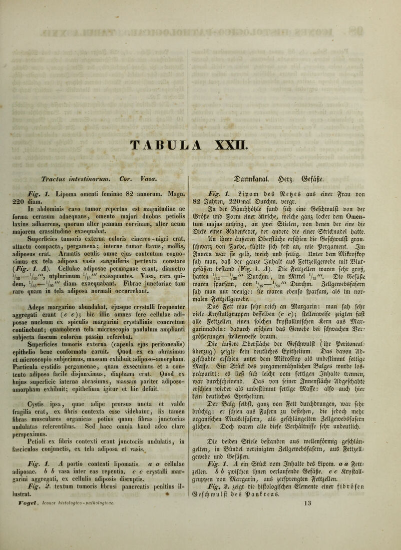 Tractus intestinorum. Cor. Vasa. Fig, 1. Liporaa omenti feminae 82 annorum. Magn. 220 diam. In abdominis cavo tumor repertus est magnitudine ac forma cerasum adaequans, omento majori duobus petiolis laxius adiiaerens, quorum alter pennam corvinam, alter acum majorem crassitudine exaequabat. Superficies tumoris externa coloris cinereo - nigri erat, attacto compacta, pergamena; interne tumor flavus, mollis, adiposos erat. Armatis oculis omne ejus contentum cogno- vimus ex tela adiposa vasis sangoiferis pertexta constare {Fig, 1. Ä). Cellulae adiposae permagnae erant, diametro 7i2 — utplurimum exaequantes. Vasa, rara qui- dem, Yas — diam, exaequabant. Fibrae junctoriae tam raro quam in tela adiposa normali occurrebant. Adeps margarino abundabat, ejusque crystalli frequenter aggregati erant (c c); hic illic omnes fere cellulae adi- posae nucleum ex spiculis raargarini crystallinis concretum continebant; qoamobrem tela microscopio paululum amplianti subjecta fuscum colorem passim referebat. Superficies tumoris externa (capsula ejus peritonealis) epithelio bene conformato caruit. Quod ex ea abrasimus et microscopio subjecimus, massam exhibuit adiposo-amorpham. Particula cystidis pergamenae, quam exsecuimus et a con- tento adiposo facile disjunximus, diaphana erat. Quod ex hujus superficie interna abrasimus, massam pariter adiposo- amorpham exhibuit; epithelium igitur et hic defuit. Cystis ipsa, quae adipe prorsus uncta et valde fragilis erat, ex fibris contexta esse videbatur, iis tamen fibras musculares organicas potius quam fibras junctorias undulatas referentibus. Sed haec omnia haud adeo clare perspeximus. Petioli ex fibris contexti erant junctoriis undulatis, in fasciculos conjunctis, ex tela adiposa et vasis. Fig. 1. Ä portio contenti lipomatis. a a cellulae adiposae, b b vasa inter eas repentia, c c crystalli mar- garini aggregati, ex cellulis adiposis disruptis. Fig. 2. textum tumoris fibrosi pancreatis penitius il- lustrat. • Voffel, Icones histologico-pathologicae. ®armfanaf. ©efd^e. Fig. 1. fiipom beg auö einer grau non 82 Sauren, 220 mal S)urd^m. üergr. Sn ber S3äuc^^6|)le fanb ftd^ eine ©efd^tnulff t>on ber ©rope unb gorm einer .^irfc^e, ml6)c ganj foifer bem Omen- tum majus an^ing, an jwei ©tiefen, üon benen ber eine bie S)iife einer 9?abenfeber, ber anbere bte einer ©tri(lnabef f)atte. 2(n ifjrer duperen £>berfldcf)e erfc^ien bie ©efc^niuljl grau= fd)n)ar5 non garbe, füllte ftc^ fejl: an, mie Pergament. Sm Snnern mar fte gelb, meic^ unb fettig. Unter bem 9)?ifroffop fa^ man, bap ber ganje Sn^aft auö gettjelfgemebe mit S5fut= gefdpen befianb (Fig. 1. A). S)ie gettjeffen maren fe^r grop, Ratten Vw—V20' Surc^m., im 59?ittel ^^e ©efdpe waren fparfam, non 735—^urdpm. Selfgemeböfafern fa^ man nur wenige: fie waren ebenfo fparfam, alö im nor= malen gett5elfgewebe. gett war fef)r reidf) an 9)?argarin: man fa^ fe^r niefe .^rpffaUgruppen beffelben (c c); fteffenweife zeigten faft affe gettjelfen einen folc^en frpftaffinifd)en .^ern auö SO?ar= garinnabefn: baburd^ erfcf)ien baö ©ewebe bei fc^wad)en SI!er- groperungen fteffenweife braun. S)te dupere £)berfldd)e ber ©efd)wufft (i^r peritoneal: überjug) jeigte fein beutlirf)e§ ©pitpefium. 2>aä baoon 3fb: gefd)abte erfd)ien unter bem Sltifroffop afS unbeftimmt fettige SD?affe. ©in ©tuef beö pergamentdi^nfid^en S3afgeö würbe foö: prdparirt: e§ fiep ftdf) fei^t nom fettigen Sn^afte trennen, war burdf)fd|)einenb. ®aö non feiner Snnenffde^e 2fbgefdf)abte erfdf)ien wieber afö unbeftimmt fettige Sötaffe: affo auc^ ^ier fein beutfidfjeö ©pit^elium. £>er ^afg fefbft, ganj non gett buri^brungen, war fepr brudf)ig: er fc^ien auö gafern ju beftefjen, bie jebodt) me^r organifc^en SÖtuöfeifafern, afö gefd^fdngeften Seffgeweböfafern gficf)en. 25odf) waren affe biefe ®er^dftniffe fe^r unbeutfidf). S)ie beiben ©tiefe beftanben aug wellenförmig gefd[)fdn: gelten, in S3unbef nereinigten SUfgeweböfafern, au§ gettjelf: gewebe unb ©efdpen. Fig. 1. A ein ©tudf nom Sn^afte beg ßipom. a a gett= jelfen. b b jwifeijen i^nen nerfaufenbe ©efdpe. c c .SJrpftalf: gruppen non 9)targarin, aug jerfprengten gettjeffen. Fig, 2. jeigt bie f)iftofogifd[)en ©femente einer fibrofen ©efcfiwufft beg Panfreag. 13