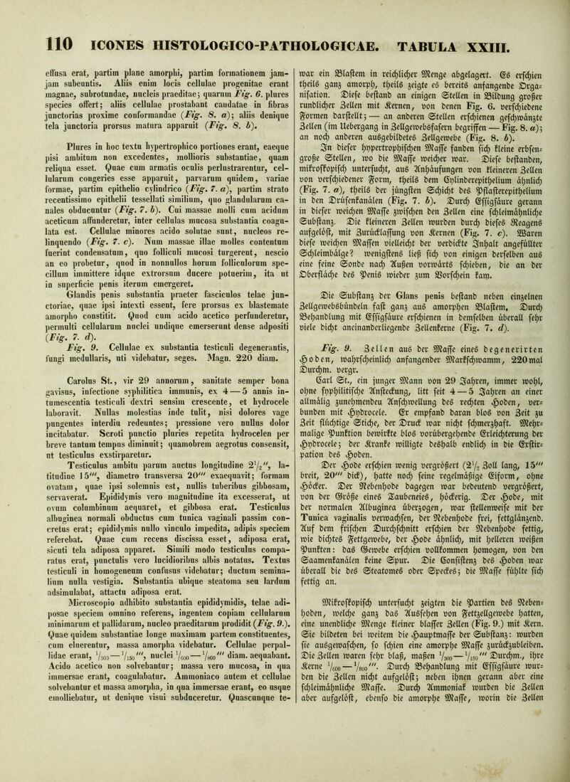 elfusa erat, partim plane amorphi, partim formationem jam- jam subeuntis. Aliis enim locis cellulae progenitae erant magnae, subrotundae, nucleis praeditae; quarum Ftg. 6. plures species offert; aliis cellulae prostabant caudatae in fibras junctorias proxime conformandae {Ftg. 8. «); aliis denique tela junctoria prorsus matura apparuit (Ftg, 8. b), Plures in hoc textu hypertrophico portiones erant, eaeque pisi ambitum non excedentes, mollioris substantiae, quam reliqua esset. Quae cum armatis oculis perlustrarentur, cel- lularum congeries esse apparuit, parvarum quidem, variae formae, partim epithelio cylindrico (Ftg, T. a), partim strato recentissimo epithelii tessellati similium, quo glandularum ca- nales obducuntur (Ftg. 7. b). Cui massae molli cum acidum aceticum affunderetur, inter cellulas mucosa substantia coagu- lata est. Cellulae minores acido solutae sunt, nucleos re- linquendo (Fig. 7. c). Num massae illae molles contentum fuerint condensatum, quo folliculi mucosi turgerent, nescio an eo probetur, quod in nonnullos horum folliculorum spe- cillum immittere idque extrorsum ducere potuerim, ita ut in superficie penis iterum emergeret. Glandis penis substantia praeter fasciculos telae jun- ctoriae, quae ipsi intexti essent, fere prorsus ex blastemate amorpho constitit. Quod cum acido acetico perfunderetur, permulti cellularum nuclei undique emerserunt dense adpositi (Plg. 7. d). Ftg. 9. Cellulae ex substantia testiculi degenerantis, fungi medullaris, nti videbatur, seges. Magn. 220 diam. Carolus St., vir 29 annorum, sanitate semper bona gavisus, infectione syphilitica immunis, ex 4 — 5 annis in- tumescentia testiculi dextri sensim crescente, et hydrocele laboravit. Nullas molestias inde tulit, nisi dolores vage pungentes interdiu redeuntes; pressione vero nullus dolor incitabatur. Scroti punctio pluries repetita hydrocelen per breve tantum tempus diminuit; quamobrem aegrotus consensit, ut testiculus exstirparetur. Testiculus ambitu parnm auctus longitudine 2Y2'') la- titudine 15''', diametro transversa 20' exaequavit; formam ovatam, quae ipsi solemnis est, nullis tuberibus gibbosam, servaverat. Epididymis vero magnitudine ita excesserat, ut ovum columbinum aequaret, et gibbosa erat. Testiculus albuginea normali obductus cum tunica vaginali passim con- cretus erat; epididymis nullo vinculo impedita, adipis speciem referebat. Quae cum recens discissa esset, adiposa erat, sicuti tela adiposa apparet. Simili modo testiculos compa- ratus erat, punctulis vero lucidioribus albis notatus. Textos testiculi in bomogeneum confusus videbatur; ductum semina- lium nulla vestigia. Substantia ubique steatoma seu lardum adsimulabat, attactu adiposa erat. Microscopio adbibito substantia epididymidis, telae adi- posae speciem omnino referens, ingentem copiam cellularum minimarum et pallidarum, nucleo praeditarum prodidit (Fig. 9.), Quae quidem substantiae longe maximam partem constituentes, cum eluerentur, massa amorpha videbatur. Cellulae perpal- lidae erant, Ysod — Viso^^Y nuclei Ygoo — diam, aequabant. Acido acetico non solvebantur; massa vero mucosa, in qua immersae erant, coagulabatur. Ammoniaco autem et cellulae solvebantur et massa amorpha, in qua immersae erant, eo usque emolliebatur, ut denique visui subduceretur. Quascunque te- mar ein SSIaftem in reic^Ii^er 9)?enge obgelagett. erfd)ien t^eUö gan5 amorpf;, tf)ei(S jeigte e§ bereite anfangenbe £)rga= nifation. ®iefe bejfanb an einigen ©teilen in S3ilbung groper runblic^er Sellen mit .fernen, non benen Fig. 6. nerfe^iebene formen barflellt;— an anberen ©teilen evfd)ienen gefc^mdnjte Sellen (im Uebergang in SeUgemebefafern begriffen — Fig. 8.«); an noc^ anberen auSgebilbeteS Sellgemebe (Fig. 8. b). Sn biefer l)ppertropl)ifd)en SWaffe fanben fici) fleine erbfen-- grope ©teilen, mo bie SÖlaffe meid)er mar. Siefe beftanben, mifroffopifcf) unterfud)t, au§ 3Cnl)dufungen non fleineren Sellen non nerfd)iebener gorm, tljeilö bem (Splinberepitljelium dl)nlid^ (Fig. 7. a), tl)eilg ber jungflen ©d)id)t beg ^flajferepitljelium in ben S)rufenfanalen (Fig. 7. b). ®urrf) ©fftgfdure gerann in biefer meicl)en fOlaffe 5mifd)en ben Sellen eine [d)leimdl)nlid^e ©ubfianj. 2)ie fleineren Seilen mürben burd) biefeö 9^eageng aufgeloft, mit Surudllaffung non Äernen (Fig. 7. c). SBaren biefe meidjen 58?affen nielleid)t ber nerbitfte Snl)alt angefdllter ©d^leimbdlge? menigftenS liep fid) non einigen berfelben auö eine feine ©onbe nad) 2(upen normdrtä fd)ieben, bie an ber SDber^dc^e beS ^eniö mieber gum SSorfd)ein fam- S)ie ©ubftanj ber Glans penis bejfanb neben einzelnen Sellgemeböbünbeln faft gang au§ amorphen S3laftem, S)urd) ^el)anblung mit ßfftgfdure erf^ienen in bemfelben überall fel)r niele bid)t aneinanbcrliegenbe Sellenferne (Fig. 7. d). Ftg. 9. Sellen aug ber SÖtaffe eineg begenerirten 1^0ben, mal)rfd)einlic^ anfangenber ^arffd)mamm, 220mal ^urd)m. nergr. (Sari ©t., ein funger 9)?ann non 29 S<tl)ten, immer mof)l, ol)ne fppl)ilitifd)e 3fnftecfung, litt feit 4 — 5 cm einer allmdlig gune^menbeu 3lnfd)meUung beg red)ten .^oben, ner= bunben mit v^pbrocele. @r empfanb baran blog non Seit gu Seit flud)tige ©ti^e, ber ®rudf mar nid)t fd)mergl)aft. fS)?el)r= malige ^unftion bemirfte blog norüberge^enbe @rleid)terung ber .^pbrocele; ber .Siranfe milligte beg^alb enblid) in bie @rftir= pation beg .^oben. 2)er .f)obe erfc^ien menig nergropert (2Yi Soll lang, 15' breit, 20' bief), Ijatte nod) feine regelmdpige (giform, ol)nc ^odfer. 2)er 9feben^obe bagegen mar bebeutenb nergropert, non ber ©rope eineg Saubeneieg, Ijocferig. ^er .f)obe, mit ber normalen Tllbuginea ubergogen, mar ftellenmeife mit ber Tunica vaginalis nermad)fen, ber S^eben^obe frei, fettgldngenb. 2(uf bem frifd)en 3ü)urd)f^nitt erfd)ien ber 9lebenf)obe fettig, mie bid)teg ^ettgemebe, ber ^obe dfjnlid), mit Ijelleren meipen 5)unften: bag ©emebe erfd)ien noHfommen l)omogen, non ben ©aamenfandlen feine ©pur. £>ie ©onfifteng beg »^oben mar überall bie beg ©teatomeg ober ©peefeg; bie SKaffe ful)lte fid) fettig an. 5i)?ifroffopifd) unterfu(^t geigten bie Partien beg S^eben^ l)oben, meld)e gang bag 2(ugfe^en non ^ettgellgemebe l)atten, eine unenblic^e fötenge fleiner blaffer Sellen (Fig. 9.) mit Äern. ©ie bilbeten bei meitem bie ^^auptmaffe ber©ubftang: mürben fie auggemafd)en, fo fd)ien eine amorpl)e 50?affe gurü^gubleiben. £)ie Sellen maren fepr blap, mapen Yaoo—ipre .^erne Yeoo — Ysoo'''- 2)urd) S3el)anblung mit (gffigfdure mur= ben bie Sellen nid)t aufgeloft; neben il)nen gerann aber eine fd)leimdf)nlid)e 5Kaffe. S)ur(^ 3lmmoniaf mürben bie Sellen aber aufgeloft, ebenfo bie amorpl)e ?0?affe, morin bie Sellen