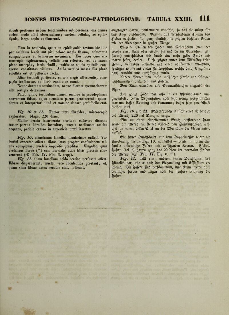 sticuH portiones iisdem tentaminibus subjiceremus, eas omnes eodem modo affici observavimus; easdem cellulas, ac epidi- dymis, larga copia exhibuerunt. Tam in testiculo, quam in epididymide textum hic illic per ambitam lentis aut pisi colore magis flavum, substantia compactiorem et firmiorem invenimus. Eos locos cum mi- croscopio exploraremus, cellulis non refertos, sed ex massa plane amorpha, lardo simili, multisque adipis guttulis coq- spersa constitutos vidimus. Acido acetico massa illa plane emollita est et pellucida facta. Aliae testiculi portiones, coloris magis albescentis, com- pagis tendinosae, ex fibris contextae erant. Neque ductuum seminalium, neque filorum spermaticorum ulla vestigia deteximus. Patet igitur, testiculum omnem omnino in pseudoplasma conversum fuisse, cujus structura parum processerat; quam- obrem et interpretari illud et nomine donare j)erdifficile erat. Ftg. 10 et 11. Tumor uteri fibroides, microscopio exploratas. Magn. 220 diam. Mulier hernia incarcerata moritur; cadavere dissecto tumor parvas fibroides invenitur, nucem avellanam ambitu aequans, petiolo crasso in superficie uteri insertus. Fig. 10. structuram lamellae tenuissimae cultello Va- lentini exsectae offert: fibras latas propter confusionem mi- nas conspicuas, nucleis impositis praeditas. Singulae, quas evolvimus fibrae (*) cum normalis uteri fibris prorsus con- venerunt (cf. Tab. rV. Fig. 6. seqq.). Fig. 11. aliam lamellam acido acetico perfusam offert. Fibrae disparuerunt, nuclei vero luculentius prostant, et, quam viam fibrae antea secutae sint, indicant. abgelagert waren, noUfommen erwei(^t, fo bap fie 3ule|t fur baö 2Cuge »erf(^wanb. Partien au§ nerfi^iebenen Steilen beS .poben nerfiielten ft^ ganj d^nli^; fte jeigten biefelben Sellen wie ber 9^eben^obe in großer 5D?enge. ©injelne ©teilen beö ,f)oben unb S^eben^oben (»on ber ©rope einer Sinfe ober (Srbfe, l^ie unb ba im ^areni^pm ;^er= fireut) unterfi^ieben ftc^ burc^ eine me^r gelbe garbe unb waren fefter, berber. ®iefe geigten unter bem Sltifroffop feine Sellen, beftanben oielme^r au§ einer oollfommen amorphen, fpecfigen 5)taffe mit vielen ^etttr6pfcl)en, welcl)e burrf) ^ffigfdurc gang erweicht unb burd)ft(^tig würbe. Qfnbere ©teilen von me^r weiplidper garbe unb [einiger S3efd()affen^eit beftanben auö ^afern. SSon ©aamenfandlen unb ©aament^ierd)en nirgenbö eine ©pur. S)er gange t^obe war alfo in ein ^feuboplaSma um= gewanbelt, beffen S)rganifation nod) felpr wenig fortgefcfiritten war unb beffen S)eutung unb SSenennung baljer fe^r gweifel^aft bleiben mup. Fig. 10 unb 11. SJtifroffopif^e 2fnftd)t eineö ^ibroib beö Uteruö, 220 mal 25urd)m. vergr. @ine an einem eingeflemmten S3rucl) verftorbene ^rau geigte am UteruS ein fleineö ^ibroib von .^afelnupgrope, wel= d)eö an einem bidfen ©fiel an ber Sberfldc^e ber ©ebdrmutter auffap. ©in feiner Surd)fcl)nitt mit bem Soppelmeffer geigte bie 3Cnorbnung, wel(^e Fig. 10. nad)bilbet — breite, in i^rem ©n= femble unbeutlirf)e ^afern mit auffi|enben Äernen. Sfotii^le ^afern (bei *) Ratten gang ba6 2Cnfe^en ber normalen ^afern beö Uteru§ (vgl. Tab. IV. Fig. 6. ff.). Fig, 11. ftellt einen anberen feinen S)ur4)fd)nift beS g^ibroibö bar, wie er nad) ber S3el)anblung mit ©fftgfdure er= f^eint. ^ie ^afern ftnb verfd)Wunben, \\)xt Äernc treten aber beutlid)er l)ervor unb geigen nod) bie frü(>ere S?id)tung ber gafern.