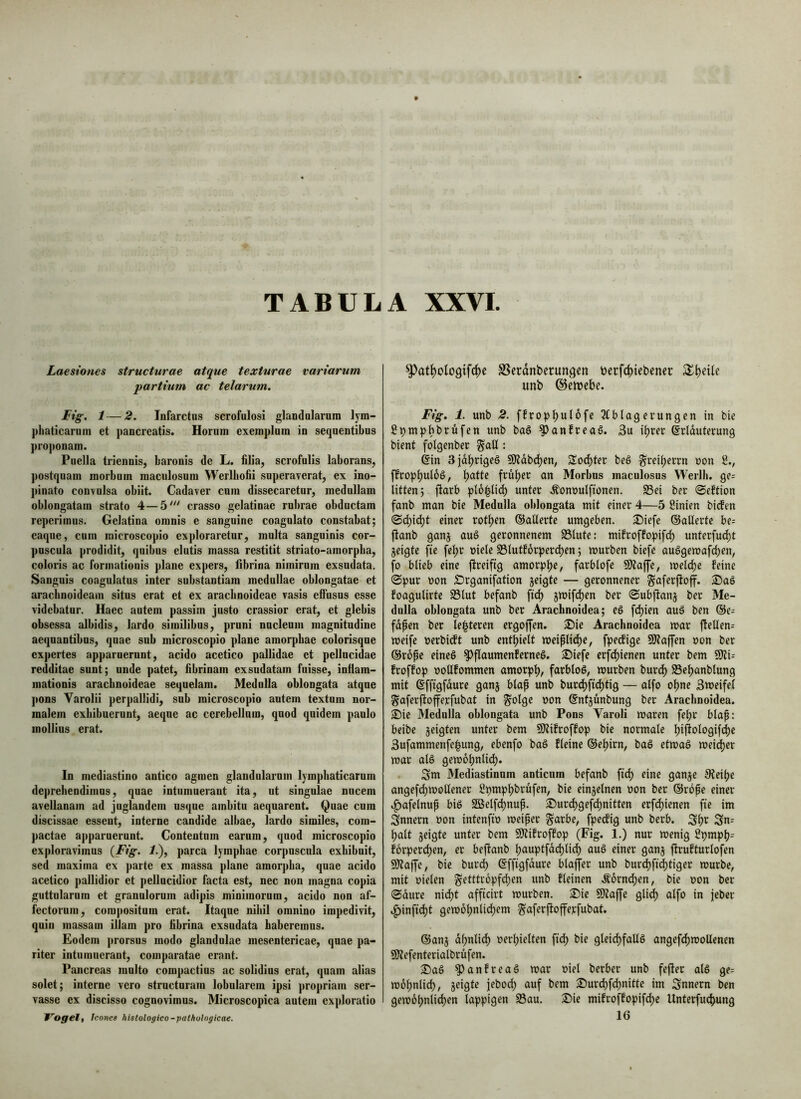 TABULA XXVI Laesiones structurae atque texturae variarum partium ac telarum. Fig. 1 — 2. Infarctas scrofulosi glandalaram lym- phaticarum et pancreatis. Horum exemplum in sequentibus proponam. Puella triennis, baronis de L. filia, scrofulis laborans, postquam morbum maculosam Werlbofii superaverat, ex ino- pinato convulsa obiit. Cadaver cum dissecaretur, medullam oblongatam strato 4—5' crasso gelatinae rnbrae obductam reperimus. Gelatina omnis e sanguine coagulato constabat; eaque, cum raicroscopio exploraretur, multa sanguinis cor- ])uscula prodidit, quibus elatis massa restitit striato-amorpba, coloris ac formationis plane expers, fibrina nimirum exsudata. Sanguis coagulatus inter substantiam medullae oblongatae et araclinoideam situs erat et ex araclinoideae vasis effusus esse videbatur. Haec autem passim justo crassior erat, et glebis obsessa albidis, lardo similibus, pruni nucleum magnitudine aequantibus, quae sub microscopio plane amorphae colorisqne expertes apparuerunt, acido acetico pallidae et pellucidae redditae sunt; unde patet, fibrinam exsudatam fuisse, inflam- mationis arachnoideae sequelam. Medulla oblongata atque pons Varolii perpallidi, snb microscopio autem textam nor- malem exhibuerunt, aeque ac cerebellum, quod quidem paulo mollius erat. In mediastino antico agmen glandularum lymphaticarum deprehendimus, quae intumuerant ita, ut singulae nucem avellanam ad juglandem usque ambitu aequarent. Quae cura discissae essent, interne candide albae, lardo similes, com- pactae apparuerunt. Contentam earum, quod microscopio exploravimus {Fig. I.), parca lymphae corpuscula exhibuit, sed maxima ex parte ex massa plane amorpha, quae acido acetico pallidior et pellucidior facta est, nec non magna copia guttularum et granulorum adipis minimorum, acido non af- fectorum, coinjiositum erat. Itaque nihil omnino impedivit, quin massam illam pro fibrina exsudata haberemus. Eodem prorsus modo glandulae mesentericae, quae pa- riter intumuerant, comparatae erant. Pancreas inulto compactius ac solidius erat, quam alias solet; interne vero structuram lobularem ipsi propriam ser- vasse ex discisso cognovimus. Microscopica autem exploratio Vogel, Icones histologico-pathologicae. ^at^ologifc^e SScrdnbcrun^en berfdjtebcner unb ©emebe. Fig. 1. unb 2. ^tblagevungen in bie fi^mpbbrufen unb baS ^anfreaS. 3u ibrec ©rtduterung bient folgenber §aU : @in Sjdbngeö 9)tdbd)en, Soc^ter beö §reii)errn non 2., ffropbuföö, b^tte früher an Morbus maculosus Werlh. ge= litten; ftarb pl6|ti(^ unter .^onnulftonen. S3ei ber 0eftion fanb man bie Medulla oblongata mit einer 4—5 2inien biefen 0(^id)t einer rotten ©alterte umgeben. Siefe ©alterte be- ftanb ganj auö geronnenem 95tute: mifroffopifd) unterfud)t jeigte fte fe^r niete S3lutf6rpercben; mürben biefe auSgemafd;en, fo blieb eine ftreifig amorphe / farblofe SJtaffe, melc^e feine 0pur non Srganifation geigte — geronnener ^aferftoff. ®aS foagulirte S3lut befanb ftd) gmif(^en ber 0ubjfanj ber Me- dulla oblongata unb ber Arachnoidea; eö fc^ien auö ben ©e= fdpen ber lei|teren ergoffen. 25ie Arachnoidea mar |fellen= meife nerbidft unb enthielt meiplid)e, fpeefige SJtajJen non ber ©rope eineö ^flaumenferneS. S)iefe erfchienen unter bem Wu froffop nollfommen amorph/ farbloö, mürben buri^ S3ehanbtung mit (gffigfdure gang blap unb burdhft(^tig — alfo ohne Smeifel gaferftofferfubat in ^olge non ©ntgünbung ber Arachnoidea. ®ie Medulla oblongata unb Pons Varoli maren fehr blap: beibe geigten unter bem fölifroffop bie normale hil^^^^ogifdhe 3ufammenfe|ung, ebenfo baö fleine ©ehirn, baö etmaö meic^er mar atö gemohntich. Sm Mediastinum anticum befanb ftd) eine gange 0ieihe angefchmoUener 2pmphbrüfen, bie eingetnen non ber ©rope einer .^afetnup biö S55elfd)nup. 3!)urdhgefchnitten erfd)ienen fte im Snnern non intenftn meiper §arbe, fpeefig unb berb. Sht halt geigte unter bem 9)tifroffop (Fig. 1.) nur menig 2pmph= forperchen, er beffanb hauptfdd)lich aug einer gang ffrufturlofen 9)ta|fc, bie burd) ©ffigfdure blaffer unb burdhft^tiger mürbe, mit nieten getttropfchen unb fleinen Ä6rnd;en, bie non ber 0dure nicht afficirt mürben. ®ie 9)?affe gli^ alfo in jeber .f)inftcht gemohnlichem ^aferjfofferfubat. ©ang dhnlidh nerhietten fidh bie gteichfallö angef^moUenen SSÄefenterialbrüfen. 3)aS ^anfreaö mar niel berber unb fefier alö ge- mohntich, geigte jebod) auf bem 2)urd)fd)nitte im Snnern ben gemohntichen lappigen 93au. 3)ie mifroffopifd;e Unterfuchung 16