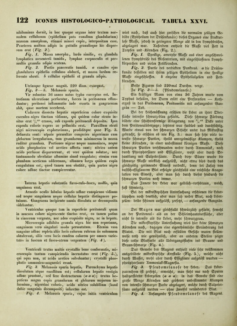 nihilominus docuit, in hoc quoque organo inter textura nor- inalein cellulosuni (epitheliniu puta canalium glandularium) massam amorpham, etiamsi minori copia, interpositam esse. Praeterea multum adipis in guttulis granulisque hic disper- sum erat (^Fig. 2.). Ftg. 1. Massa amorpha, lardo similis, ex glandula lymphatica mesenterii tumida, lymphae corpusculis et per- multis granulis adipis scatens. Fig. 2. Portio pancreatis tumidi. « canales ejus glandulares epithelio celluloso obducti, et massa lardum re- ferente obruti, b cellulae epithelii et granula adipis. Utriusque figurae magnit. 220 diam, exaequat. Ftg. 3—5. Melanosis spuria. Vir robustus 36 annos natus typho correptus est. In- testinum ulceratione ])erforatur, faeces in peritoneum efliin- duntur; peritonei inflammatio inde exorta in gangraenam abit, quae mortem accelerat. Cadavere dissecto hepatis superficiem colore exquisite caeruleo-nigro tinctam vidimus, qui quidem color strato in- situs erat crasso, sub capsula peritoneali deposito. Ipsa capsula coloris expers ac pellucida erat. Pauxillum strati nigri microscopio exploravimus, prodiditqne quae Fig. 3. delineata sunt: utpote permultas congeries nigerrimas cum glebarum irregularium, tum granulorum minimorum in massa ruditer granulosa. Portiones nigrae neque ammoniaco, neque acido phosphorico vel acetico affecta sunt; nitrico autem acido perfusae disparuerunt, et vere quidem solutae, nec tantummodo obvelatae albumine simul coagulato; etenim cum plumbum aceticum adderemus, albumen larga quidem copia coagulatum est, quod tamen non obstitit, quin partes nigro colore adhuc tinctae conspicerentur. Interna hepatis substantia flavo-rufo-fusca, mollis, qnin unguinosa erat. Armatis oculis lobulos he|)atis adhuc conspicuos vidimus sed neque sanguinem neque cellulas hepatis distinguere po- tuimus. Gangraena incipiente omnia dissoluta ac decomj)osita videbantur. Ventriculus quoque tam in superficie |)critoneali quam in mucosa colore nigrescente tinctus erat, eo tamen potius in cinereum vergente, nec adeo exquisite nigro, ac in hepate. Microscopio adhibito grannla nigra hic non reperimus, sanguinem vero singulari modo permutatum. Etenim vasa sanguine adhuc rejdeta aliis locis colorem rubrum iis solemnem obtulerunt, aliis vero locis eundem colorem per omnes varie- tates in fuscum et fusco-atrum vergentem (Fig. 4). Ventriculi textus multis crystallis hene conformatis, mi- croscopio tantum conspiciendis incrustatus erat (Ftg. 5.), qui aqua non, at acido acetico solvebantur; crystalli phos- phatis ammonico-magnesici erant. Ftg. 3. Melauosis spuria hepatis. Parenchyma hepatis dissolutum atque emollitum est; cellularum hepatis vestigia adhuc prostant, sed fere destructarum (a a a); textus he- paticus magna copia granulorum et glebarum majorum in- formium, nigerrimi coloris, acido nitrico solubilium (haud dubie sanguinis decompositi) infarctus est. Fig. 4. Melanosis spuria, cujus initia ventriculum ipie§ nad), bap auc^ ^ier bic normalen seifigen @e= bilbe (©pit^elium ber JDrufenfandle) biefeö Drganeö eine jfru!tur= lofe 9)?affe, jebod) in geringerer SJienge alg in ben Spmp^brufen, abgelagert mar. ?Cuperbem entljielt bie 9)?affe oiel ^ett in 3!ropfen unb-.^orne^en (Fig. 2.). Ftg. 1. 0pecfige, amorppe 9)?a[fe au§ einer angefe^moU lenen Spmp^brufe beö 9}?efenterium, mit eingefdjloffenen 2pmpl;= forperd^en unb oielen ^ettforndben. Ftg. 2. Lartie beS oerbieften ^anfreag. a bie S)rufen= fandle beffelben mit i^rem jelligen Spit^elium in eine fpedige DJtajJe eingefc^loffen. b einjelne ßpit^elialjellen unb ^ett= forndjen. S3eibe ^iQuren ftnb 220 mal S)urd)m. nergr. 3u Fig. 3—5. (Pfeubomelanofe.) Gin frdftiger 9)?ann non etma 36 Salyren murbe oom STpplyug befallen^ ber S)arm erlitt eine Perforation — .^otl;= ergup in bag Peritoneum, Peritoneitis mit anfangenber @an= grdn — Sob. Sei ber 2eid)en6ffnung erfd)ien bic Seber an iprer S)ber= fldcf)e intenfio fcfjmars^blau gefdrbt. ®iefe fdjmarje ^drbung bilbete eine fd)id)tcnf6rmigc 2fblagerung non 74''' X)i(Se unter bem Peritonealuberjuge; lenterer mar farblog unb bur^fic^tig. 2Burbe etmag non ber fd)marsen <Scl)i(^t unter bag SOtifroffop gebrad^t, fo erfdjien eg mie Fig. 3.: man fa^ fe^r niele in= tenfin fdjmarse Partien, tf)cilg unregelmdpigc .^lumpen, tf)eilg fleine .korndyen, in einer unbeftimmt fornigen Sftaffe. ®iefe fc^marsen Partien nerfi^manben meber burc^ 3fmmoniaf, no^ burd) pi)ogp^orfdure unb gffigfdure, mo^l aber burcj) Sc= lyanblung mit 0alpcterfdurc. 3)urd) biejc 0dure murbe bie fc^marse 9)?affe mirflicf) aufgeloft, nic^t etma blog burc^ bag glei(^Seitig gerinnenbe ©imeip nerbe(ft, benn bei 3ufaip non bafif(^=efftgfaurem Slei erfolgte gleid)fallg eine reic^lid)e Äoagu= lation non ©irneip, aber man fa^ burd) biefeg ^inburd) bic fc^marjen Partien nod) immer. Sag Snnere ber Seber mar gelblid) = rotl)braun, meid), faft fc^mierig. Sei ber mifroffopife^en Unterfud)ung erfd^ienen bie Seber= ldppd)en nod) beutlid), aber man fal) meber Slut, nod) Sebcr= selten: beibe fd)ienen aufgeloft, — anfangenbc ©angrdn. Ser ?D?agen mar glei(^fatlg fd)mdrslid) gefdrbt, fomol)t an ber PeritoneaU alg an ber 0c^leimf)autoberfIdd)e, aber nid)t fo intenftn alg bic Seber, mel;r fdymarsgrau. Sie mifroffopifd)c Unterj^ud)ung mieg l;ier feine f(^mai*sen .^6rnd)cn na(^, bagegen eine eigentt)umlid)e Serdnberung beg Sluteg. Sie mit Slut nod; erfüllten ©efdpe maren ftellen= meife rot^ mie gem6t;nlid), aber an anberen stellen sfiQff biefc rot^e Slutfarbe alie Ucberganggftufen ing Sraune unb Sraun=f<^marse (Fig. 4.). Sag ©emebe beg ^ageng enthielt niele fef;r nollfommen auggcbilbete mifroffopifd)e Ärpftalle (Fig. 5.), meld)c nid)t burc^ SEBaffer, mo^l aber burd^ ©fftgfdure aufgeloft mürben — plyogp^orfaure 2(mmoniaf=9)?agnefta. Ftg 3. Pfcubomelanofc ber Seber. Sag Seber= parend)pm ift ermcid)t, man fte^t nur nod) 0puren ^albserjforter Sebersetlen (a a a): in bag ©emebe ftnb eine grope 9)tengc .^6rnd)en unb groperer unbeftimmter Älumpen non intenftn fd)marser §arbc abgelagert, meld)C burd) 0alpeter= fdure aufgeloft merben — o^ne 3weifel nerdnberteg Slut. Ftg. 4. 3fnfangenbe Pfeubomelanofe beg SJtageng.