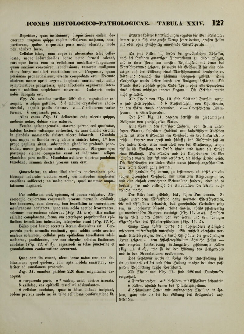 Repetitae, quas instituimus, disquisitiones eadem do- cuerunt: magnam quippe copiam cellularum majorum, com- pactiorum, quibus corpuscula puris modo admixta, modo non admixta fuere. Cellulae istae, cum neque in abscessibus telae cellu- losae, neque indurationibus bonae notae formari soleant, earumqne forma cum ea cellularum medullari - fungosarum quam maxime conveniret; conclusimus, tumorem malignum et ex fungo medullari constitutum esse. Prognosis, quam pessimam pronuntiavimus, eventu com])robata est. Exeunte nimirum mense aprili aegrota inopinato mortua est, nullis sym|)tomatibus praegressis, quae affectionis organorum inter- norum nobilium suspicionem moverent. Cadaveris sectio nobis denegata est. Fig. 10. omnibus partibus 220 diam, magnitudine ex- aequat. a adipis guttulae, b h tabulae crystallorum chole- stearini, angulis paullo obtusae, c — i cellularum variae formae. It corpuscula puris. Alius casus Fig, 11. delineatus est; ulceris quij)pe, melioris notae, dubiae vero naturae. ' Femina quinquagenaria, staturae parvae sed quadratae. Labitus laxioris vultusque cachectici, ex anni dimidio circiter in glandula mammaria sinistra ulcere laboravit. Glandula ipsa magna et flaccida erat; ulcus a sinistro latere, V‘ fere prope papillam situm, substantiam glandulae profunde pene- trabat, nucem juglandem ambitu exaequabat. Margines ejus partesque vicinae comjiactae erant et induratae; reliqua glandulae pars mollis. Glandulae axillares sinistrae paululum tumebant; mamma dextra prorsus sana erat. Quaerebatur, an ulcus illud simplex et chronicum par- tibusque induratis cinctum esset, cui methodus simpliciter emolliens sufficeret; an malae notae, quod mammae ampu- tationem flagitaret. Pus subflavum erat, spissum, et bonum videbatur. Mi- croscopio exploratura corpuscula prorsus normalia exhibuit, fere innumera, cum discreta, tum tessellatim in concretiones membranosas conjuncta, quae cum acido acetico irrorarentur, solemnes conversiones subierunt {Fig 11. a a). His multae cellulae complanatae, forma sua ceterisque proprietatibus epi- thelium tessellatum indicantes, interjectae erant {Fig. 11. b). Biduo post humor secretus iterum disquisitus est. Cor- puscula puris normalia continuit, quae addito acido acetico nucleos solemnes, cellulas puta epithelium tessellatum adsi- mulantes, prodiderunt, nec non singulas cellulas fusiformes caudatas {Fig. 11. d d), cujusmodi in telae junctoriae et granulationum conformatione occurrunt. Quae cura ita essent, ulcus bonae notae esse non du- bitavimus; quod quidem, cum apta medela curaretur, ce- leriter ad sanationem processit. Fig. 11. omnibus partibus 220 diam, magnitudine ex- aequat. a corpuscula puris, a * eadem, acido acetico irrorata. b cellulae, eas epithelii tessellati adsimulantes. d cellulae caudatae, quae in fibras diffindi incipiunt, eodem prorsus modo ac in telae cellulosae conformatione fit. 9)?e^rere fpdtere Unterfu^ungm ergaben biefefben 9?efultate: immer jeigte ftd) eine grope SKenge jener berben, gropen 3eUen mit ober of)ne glei(^5eittg anmefenbe 6iterf6rper(^en. jene Selten ftd) meber bei gen>6^nlid)en 2lbfceffen, nod) bei fonftigen gutartigen Snburationen ju bUben pflegen, unb in ii)rer ^orm am meiften 3fe^nlid)feit mit benen beö SD?arffd)mammeö jeigten, fo mürbe bie @efd)mulfi fur eine bog= artige auf ber Silbung eineö SO?arffd)mammeö berul)enbc er- fldrt unb bemnad) eine fd)limme ^rognofc gefteUt. S5iefe SSorf)erfagc murbe leiber burd) ben ^uggang befidfigt. S)ie .^ranfe ftarb pl6|lid) gegen 6nbe 2(pril, ol)nc aUe ©pmptomc eineö ßeibenö mic^tiger innerer Örgane. ^ie «Seftion murbe nid)t gefiattet. Me SI;eile oon Fig. 10. finb 220 mal ®urd)m. oergr. a ftnb ^etttropfd)en. b b ÄrpfiaUtafeln oon G^olefiearin, an ben @d’en etmaS abgerunbet. c — i oerfd)iebene 3ellen= formen, k @iterforperd)en. 2)er ^att Fig. 11. bagegen betrifft ein gutartige^ ®efd)mur oon jmeifell)after 9Zatur. @ine Srau in ben funfjiger Scd)ren, oon fleiner untere fe|ter «Statur, fd)led)tem »^abitug unb fad)eftifd)em Möfel)en ()atte feit etma 6 SKonaten ein ®efd)mur an ber linfen S3ruft= brufe. 2e|tere mar grop unb fd)laff; bad @efd)mur fap an ber linfen Seite, etma einen 3oU oon ber Srujimarje, reid)tc tief in bie Sub^anj ber ®rufe l)inein unb l)atte bie ©rope einer Sffiallnup. 2)ie S^dnber unb bie Umgebungen beö @e= fc^müreö maren fef)r feft unb oerl)drtet, bie übrige ©rufe meic^. ©ie 2(d)felbrufen ber linfen Seite maren fd)ma^ angefd)mollen. ©ie red)te S3rujl gan^ normal. @6 f)anbelte ftd) barum, ju befiimmen, ob biefeö ein ein- fad)eö (^ronifd)e6 ®efd)mur mit inburirten Umgebungen fei), unb eine einfad) ermeid)enbe Se^anblung forbere, ober ob ed boöartig fei) unb oieUeid)t bie 2fmputation ber S5ruft noü)- menbig ma(^e. ©er ßiter mar gelblid), bicf, fd)ien Pus honum. (?r jcigte unter bem SlUfroffope ganj normale ©terforpercfien, •bie mit ßffigfdure bel)anbelt, baö gem6l)ntidf)e SSer^alten jeig^ ten, in ungel)earer 2fn3af)l, tl)eilö einjeln, tf)eilö pflaflerartig ju membranofen ©ruppen vereinigt (Fig. 11. a a). 3mifd)en biefen viele platte 3eUen von ber ^orm unb ben fonjiigen ©igenfd)aften beö ^flafterepit^elium (Fig. 11. b). ©inige Sage fpdter murbe bie abgefonberte glüffigfeit mieberum mifroffopifd) unterfud)t. Sie enthielt ebenfaUö nor= male ©iterforperd)en, melc^e burd) ©fftgfdure bie gemof)nlid)en .^erne jeigten — bem ^flafterepitl)elium d^nlid)e 3eöen — unb einzelne fpinbelfdrmig verldngerte, gefd)mdn3te 3rllrn (Fig. 11. d d), mie fte bei ber 93ilbung beS Selfgemebeä unb in ben ©ranulationen vorfommen. ©aö ©efd)mur murbe in §olge biefer Unterfud)ung für ein gutartige^ erfldrt unb feine »Teilung ma(f)te bei einer paf- fenben S3el)anblung rafc^e §ortfd)ritte. Me Sl;eile von Fig. 11. finb 220 mal ©urd)meffer vergropert. a ©iterforperd)en. a * biefelben, mit ©ffigfdure bel)anbelt. b 3rllfn, dl)nlic^ benen beö ^flafterepitl)elium. d gefd)mdn3te Sellen mit anfangenber Sl)eilung in fern, ganj mie bie bei ber 58ilbung beö 3ellgemebe§ auf- tretcnben.