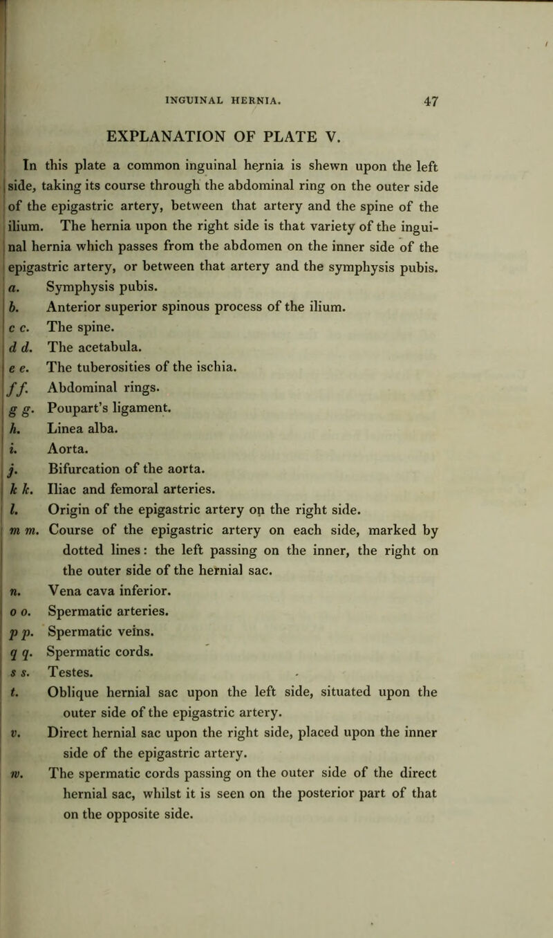 1 INGUINAL HERNIA. 47 EXPLANATION OF PLATE V. In this plate a common inguinal hejrnia is shewn upon the left | side, taking its course through the abdominal ring on the outer side of the epigastric artery, between that artery and the spine of the ilium. The hernia upon the right side is that variety of the ingui- nal hernia which passes from the abdomen on the inner side of the epigastric artery, or between that artery and the symphysis pubis. a. b. c c. dd. e e. ff gg- li. 3• hk. 1. m m. n. o o. pp. qq. s s. t. Symphysis pubis. Anterior superior spinous process of the ilium. The spine. The acetabula. The tuberosities of the ischia. Abdominal rings. Poupart’s ligament. Linea alba. Aorta. Bifurcation of the aorta. Iliac and femoral arteries. Origin of the epigastric artery on the right side. Course of the epigastric artery on each side, marked by dotted lines: the left passing on the inner, the right on the outer side of the hernial sac. Vena cava inferior. Spermatic arteries. Spermatic veins. Spermatic cords. Testes. Oblique hernial sac upon the left side, situated upon the outer side of the epigastric artery. Direct hernial sac upon the right side, placed upon the inner side of the epigastric artery. The spermatic cords passing on the outer side of the direct hernial sac, whilst it is seen on the posterior part of that on the opposite side.