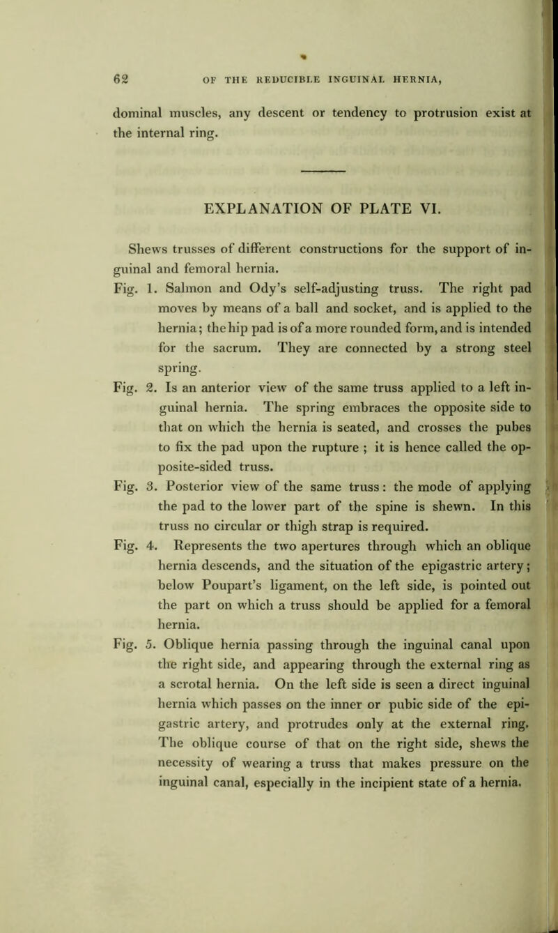 dominal muscles, any descent or tendency to protrusion exist at the internal ring. EXPLANATION OF PLATE VI. Shews trusses of different constructions for the support of in- guinal and femoral hernia. Fig. 1. Salmon and Ody’s self-adjusting truss. The right pad moves by means of a ball and socket, and is applied to the hernia; the hip pad is of a more rounded form, and is intended for the sacrum. They are connected by a strong steel spring. 1 Fig. 2. Is an anterior view of the same truss applied to a left in- guinal hernia. The spring embraces the opposite side to that on which the hernia is seated, and crosses the pubes to fix the pad upon the rupture ; it is hence called the op- posite-sided truss. Fig. 3. Posterior view of the same truss: the mode of applying the pad to the lower part of the spine is shewn. In this truss no circular or thigh strap is required. Fig. 4. Represents the two apertures through which an oblique hernia descends, and the situation of the epigastric artery; below Poupart’s ligament, on the left side, is pointed out the part on which a truss should be applied for a femoral hernia. Fig. 5. Oblique hernia passing through the inguinal canal upon the right side, and appearing through the external ring as a scrotal hernia. On the left side is seen a direct inguinal hernia which passes on the inner or pubic side of the epi- gastric artery, and protrudes only at the external ring. The oblique course of that on the right side, shews the necessity of wearing a truss that makes pressure on the inguinal canal, especially in the incipient state of a hernia.