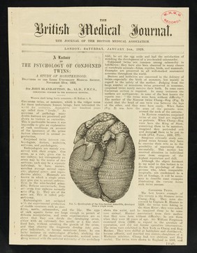 [Cutting from the Britsh medical journal: "A lecture on the psychology of conjoined twins: a study of monsterhood". Daisy and Violet Hilton are shown].