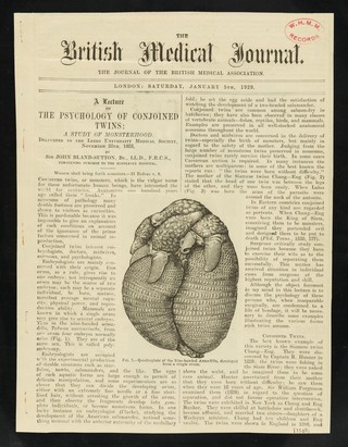 [Cutting from the Britsh medical journal: "A lecture on the psychology of conjoined twins: a study of monsterhood". Daisy and Violet Hilton are shown].