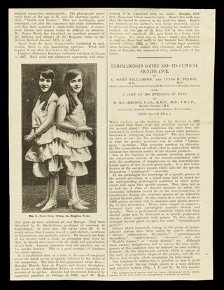 [Cutting from the Britsh medical journal: "A lecture on the psychology of conjoined twins: a study of monsterhood". Daisy and Violet Hilton are shown].