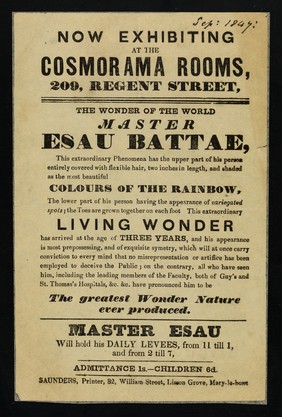 Now exhibiting at the Cosmorama Rooms, 209, Regent Street : the wonder of the world, Master Esau Battae.