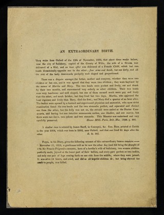 An extraordinary birth.