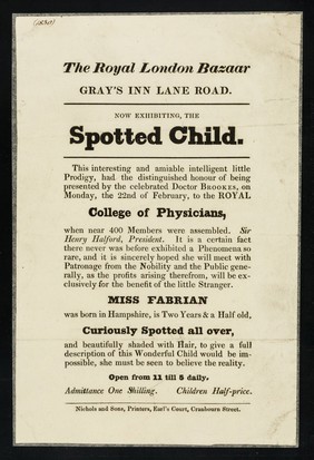 The Royal London Bazaar, Gray's Inn Road : now exhibiting, the Spotted Child ... Miss Fabrian was born in Hampshire is two years & a half old, curiously spotted all over ...