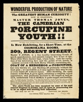 Wonderful production of nature : the greatest human curiosity! Now in existence, Master Thomas Jones, the Cambrian Porcupine Youth!! ... is now exhibiting, for a short time, at the Cosmorama Rooms, 209 Regent Street.