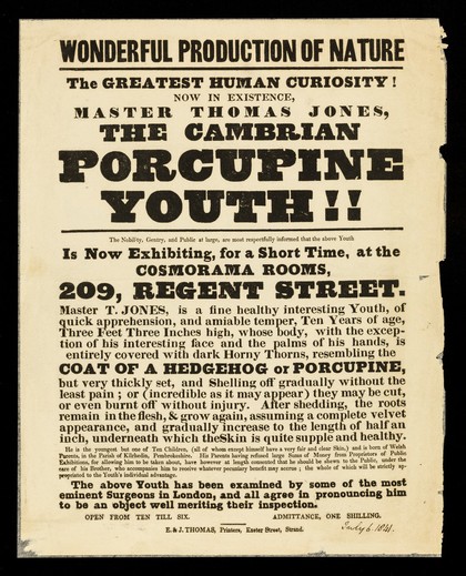 Wonderful production of nature : the greatest human curiosity! Now in existence, Master Thomas Jones, the Cambrian Porcupine Youth!! ... is now exhibiting, for a short time, at the Cosmorama Rooms, 209 Regent Street.