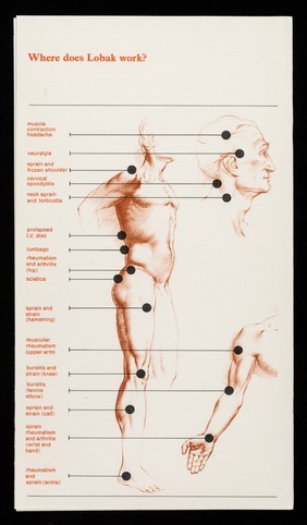 In all muscular pain Tab. Lobak : where does Lobak work?.