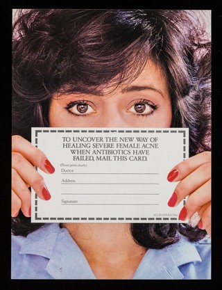To uncover the new way of healing severe female acne when antibiotics have failed, mail this card : Diane cyproterone acetate and ethinyloestradiol.