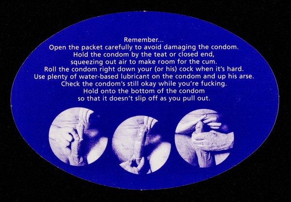 Remember... : open the packet carefully to avoid damaging the condom ... / RS Health.