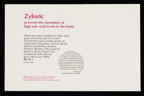 Zyloric prevents the formation of high uric acid levels in the body : apply a raw lean beef-steak to the gouty part ...