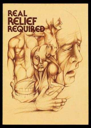 Real relief required : for pain of all dimensions prescribe Doxypol first.