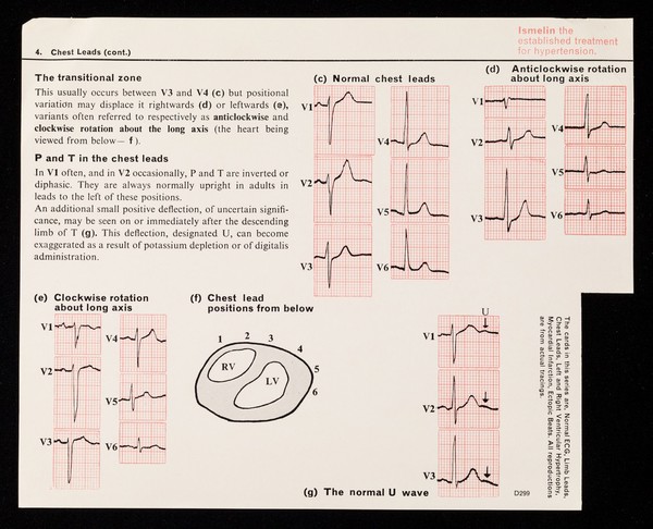 4. chest leads : six chest lead positions are defined by international agreement (a).