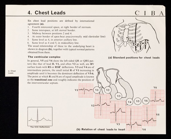 4. chest leads : six chest lead positions are defined by international agreement (a).
