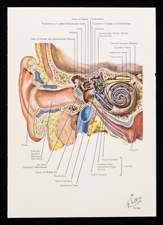 Locorten-Vioform Eardrops.