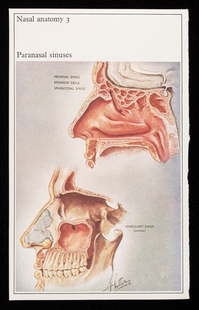 Nasal anatomy 3 : paranasal sinuses : Otrivine.