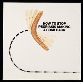 How to stop psoriasis making a comeback : the growing reputation of Dithrocream.